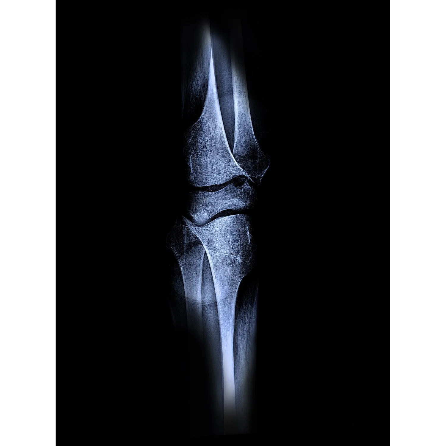 The Bone Wore series