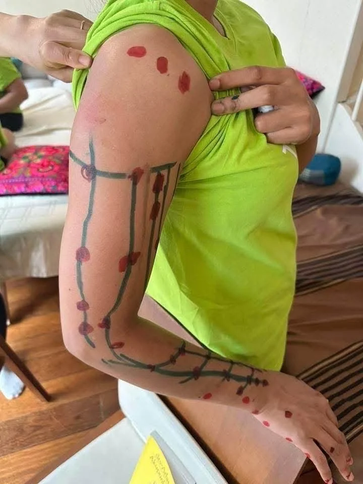 Arm acupuncture points. Massage Training Camp