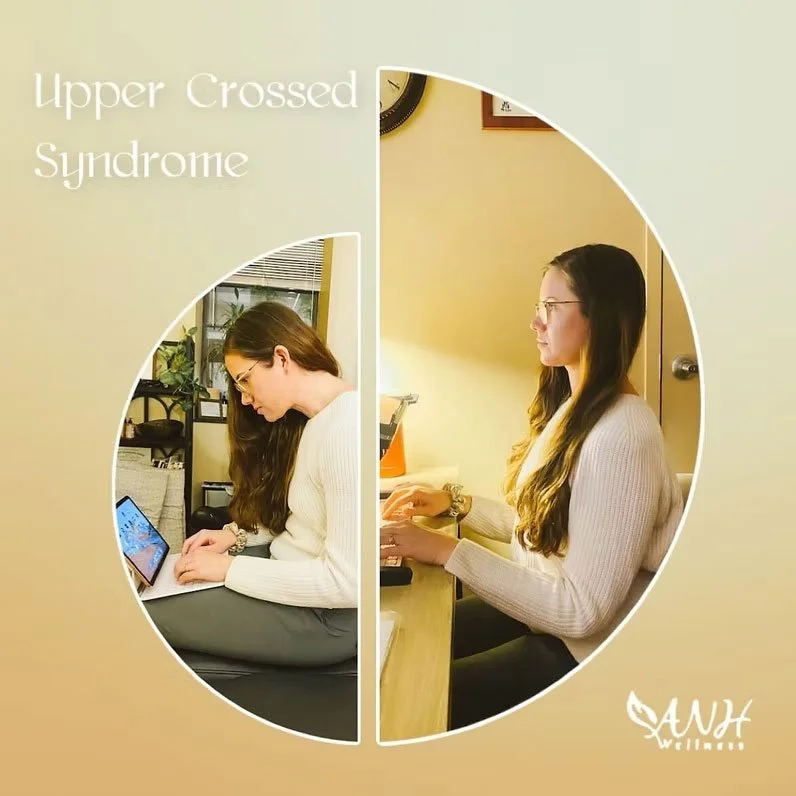 Upper Crossed Syndrome – Stop That Slouch!