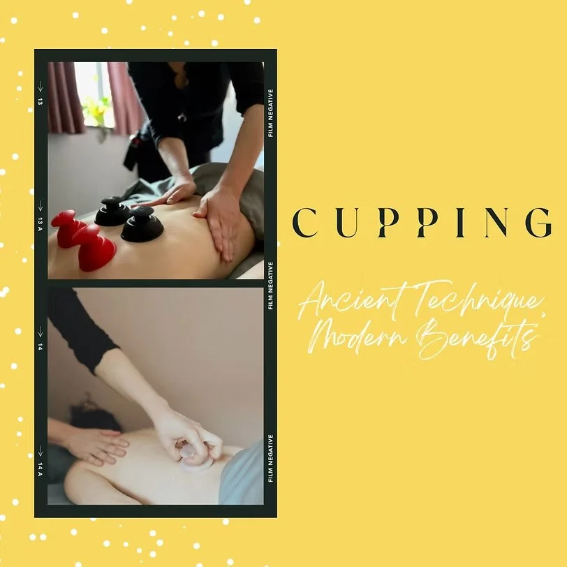 Cupping: Ancient Techniques - Modern Benefits