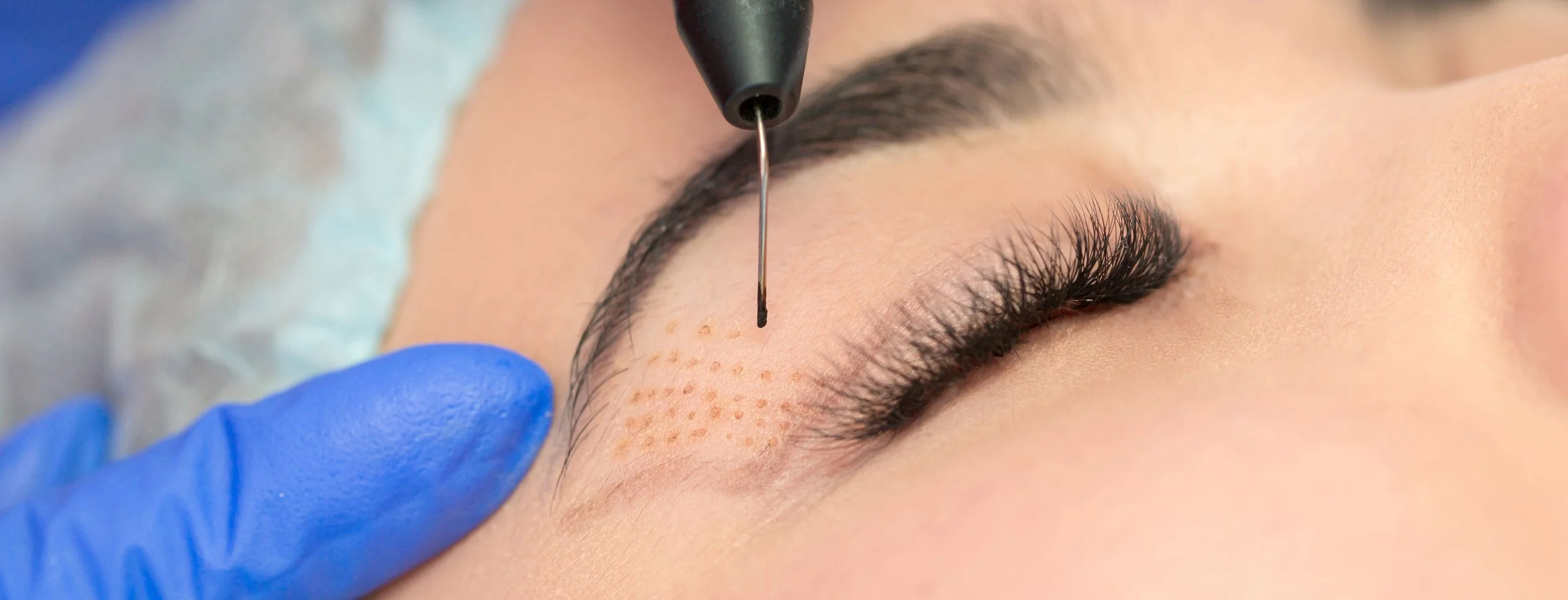 Une personne reçoit une procédure de microblading pour ses sourcils par un professionnel portant des gants bleus.