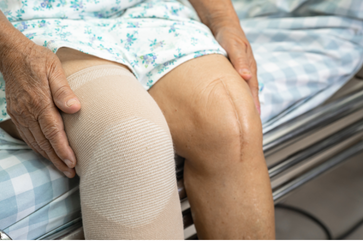 Close-up of an elderly person's knee with a beige knee brace, sitting on a hospital bed.