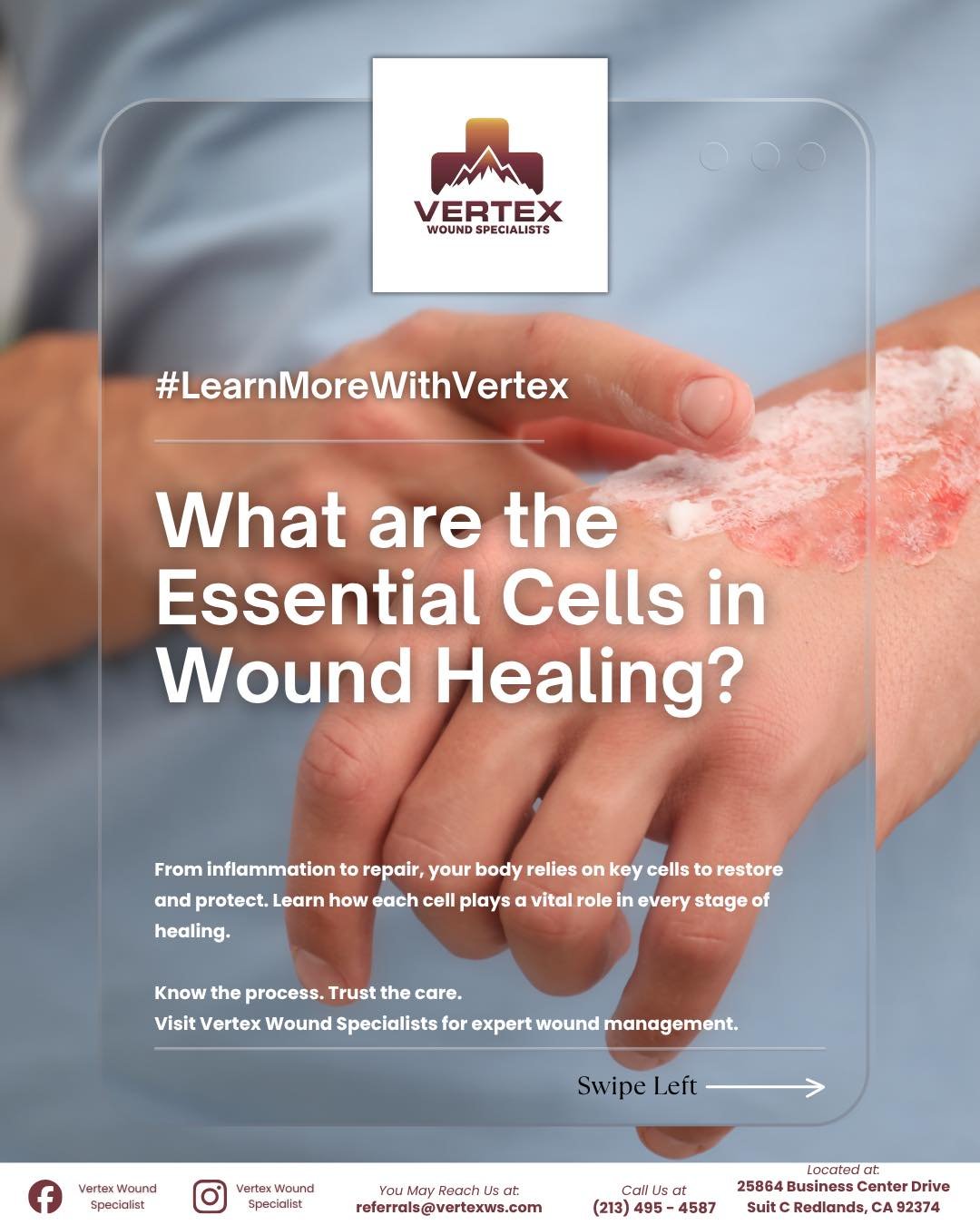 #LearnMoreWithVertex: Essential Cells in Wound Healing

Discover the powerhouse cells that drive every step of wound repair, from platelets that stop bleeding, to macrophages that coordinate healing, to fibroblasts and keratinocytes that rebuild tiss