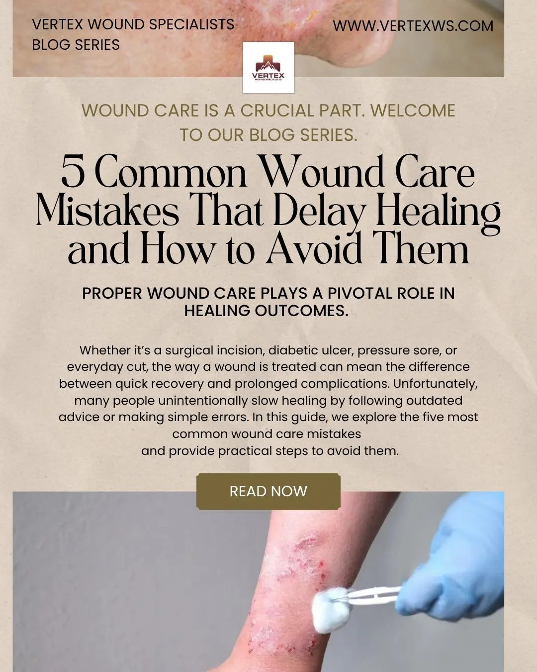 𝗩𝗲𝗿𝘁𝗲𝘅 𝗪𝗼𝘂𝗻𝗱 𝗦𝗽𝗲𝗰𝗶𝗮𝗹𝗶𝘀𝘁𝘀: 𝗕𝗹𝗼𝗴 𝗦𝗲𝗿𝗶𝗲𝘀

Don&rsquo;t let simple wound care mistakes delay your healing. 

That small wound you&rsquo;re ignoring? It could turn into something more serious if not managed properly. From us