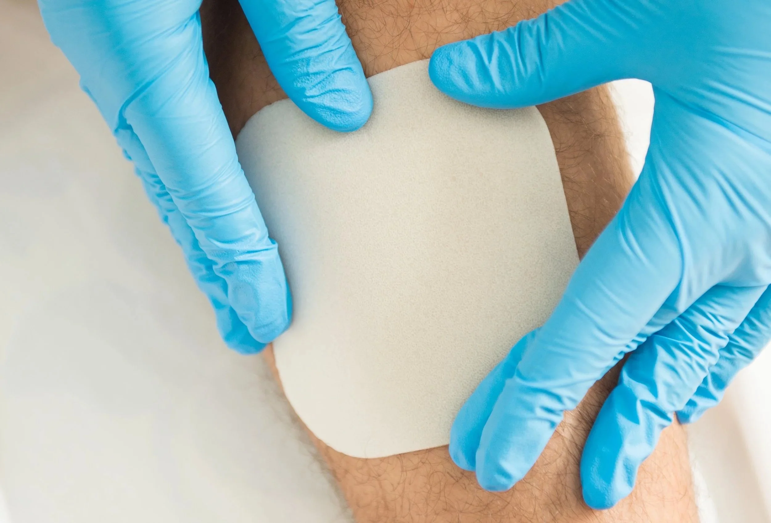 Infected Wounds: Signs You Should Never Ignore.   