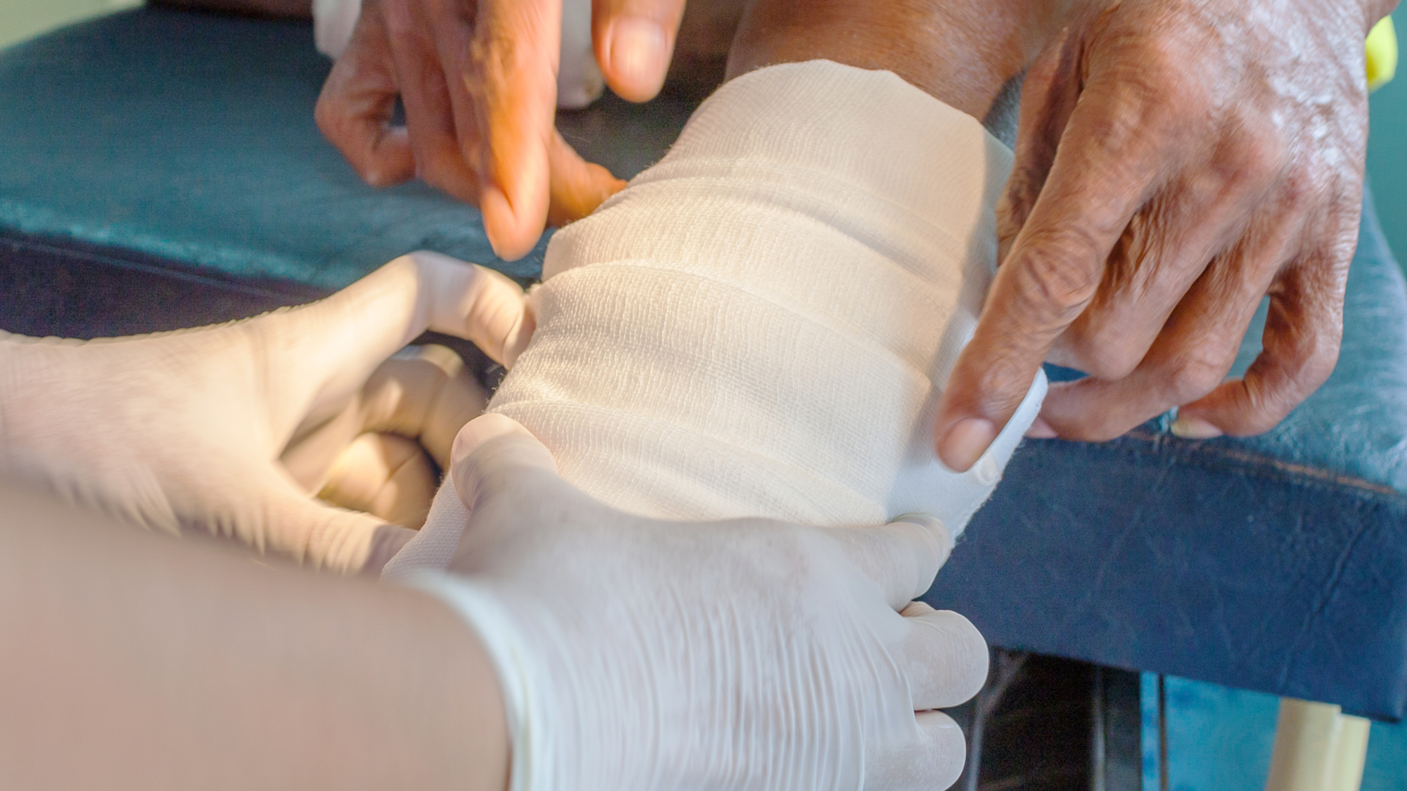 Hidden in the Folds: The Hidden Epidemic of Intertriginous Wounds and How to Heal Them