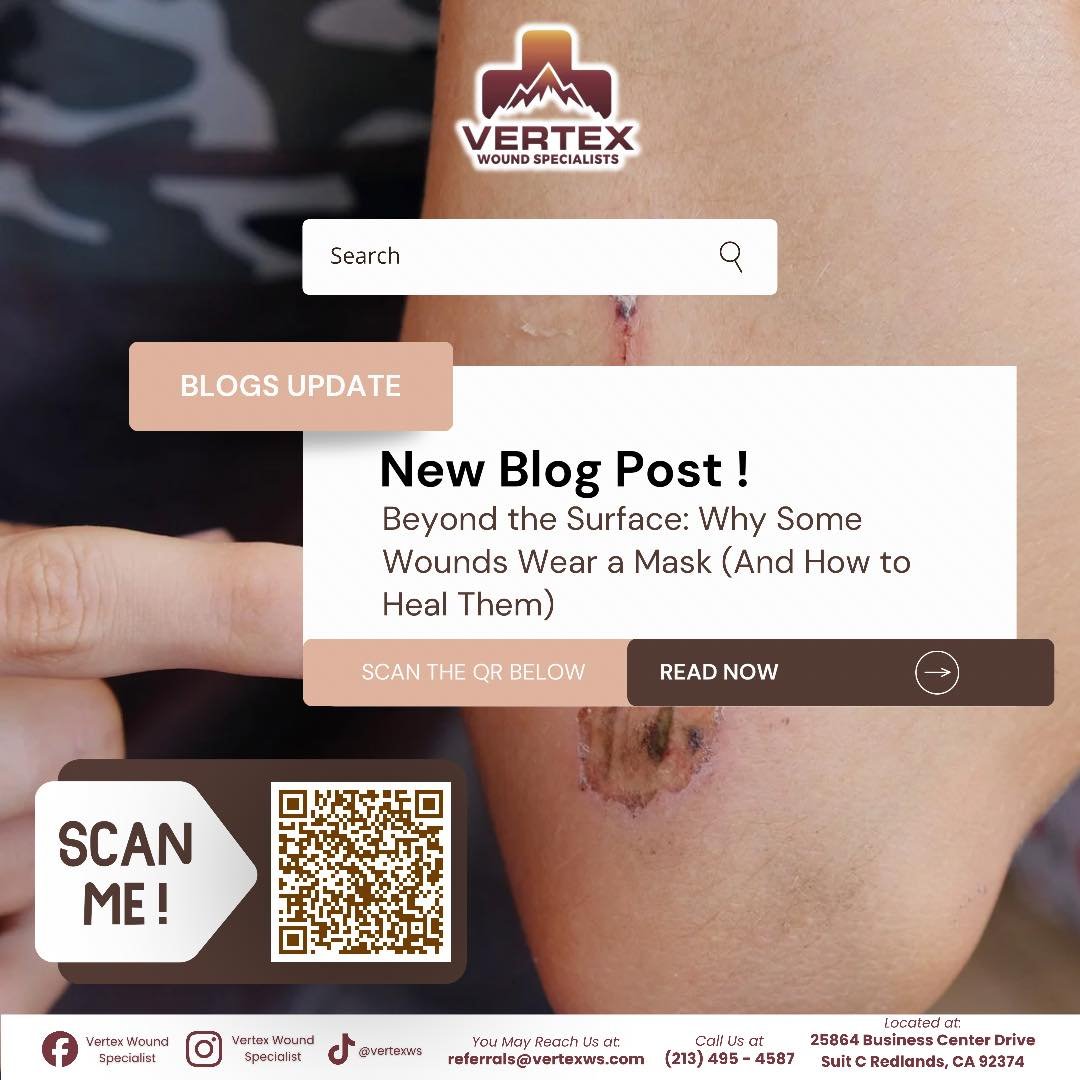 Why do some wounds refuse to heal? 

It turns out, some wounds wear a mask. Known as "Chameleon Wounds" or atypical ulcers, these injuries look ordinary on the surface but are driven by hidden systemic conditions or microscopic bacterial fo