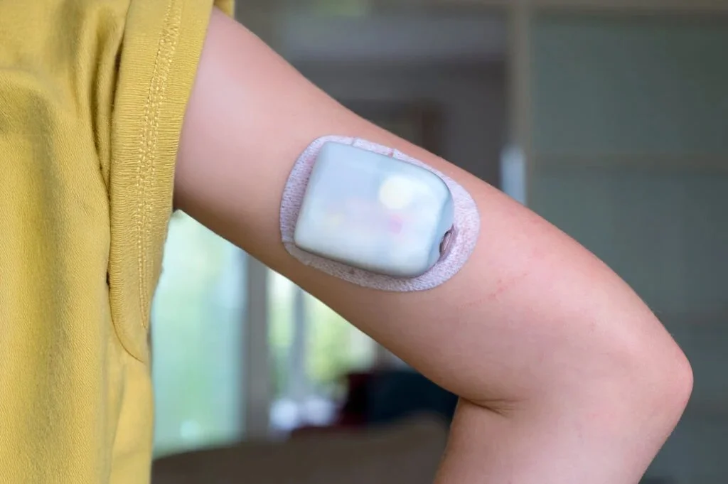Close-up of a person's upper arm with an omnipod.