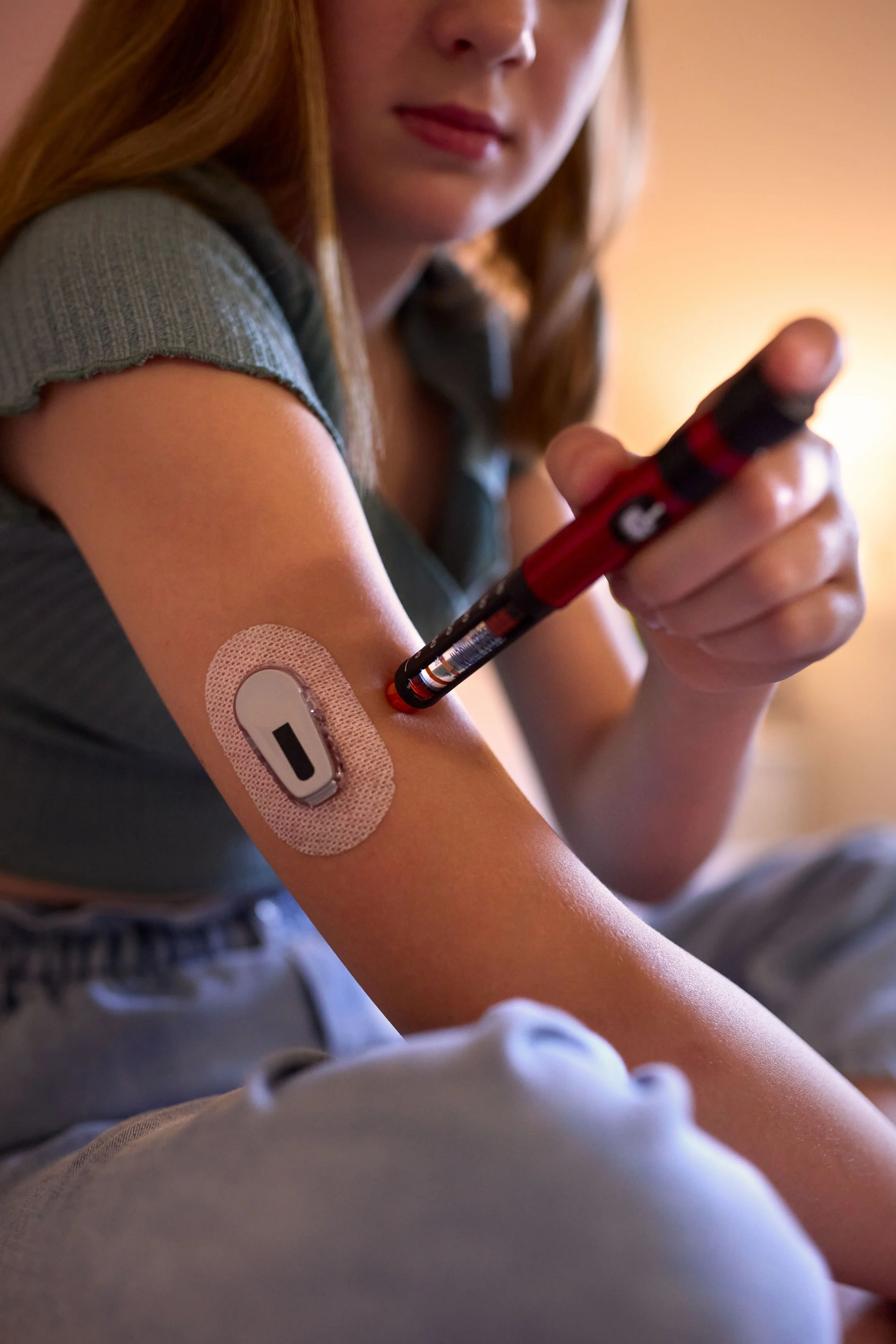 A young woman is inserting a medical insulin pen into her arm, which has a CGM (continuous glucose monitor) patch attached.