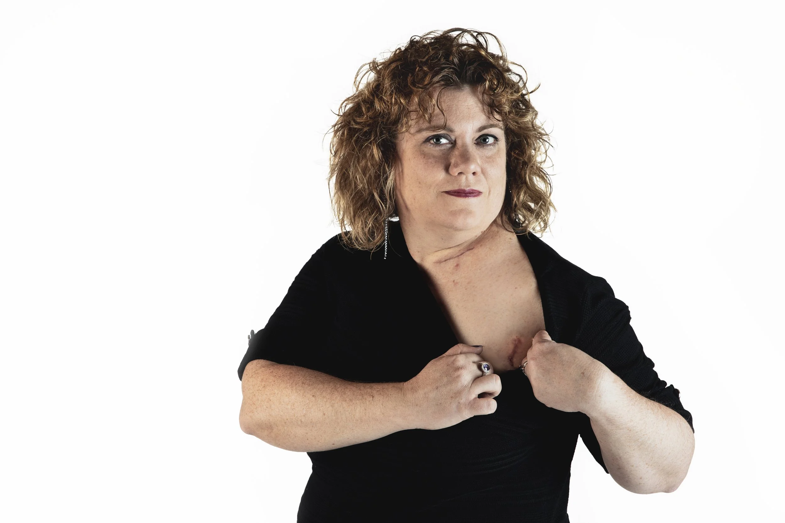 Woman with curly light brown hair wearing a black top, pulling open her shirt to reveal a scar on her chest.