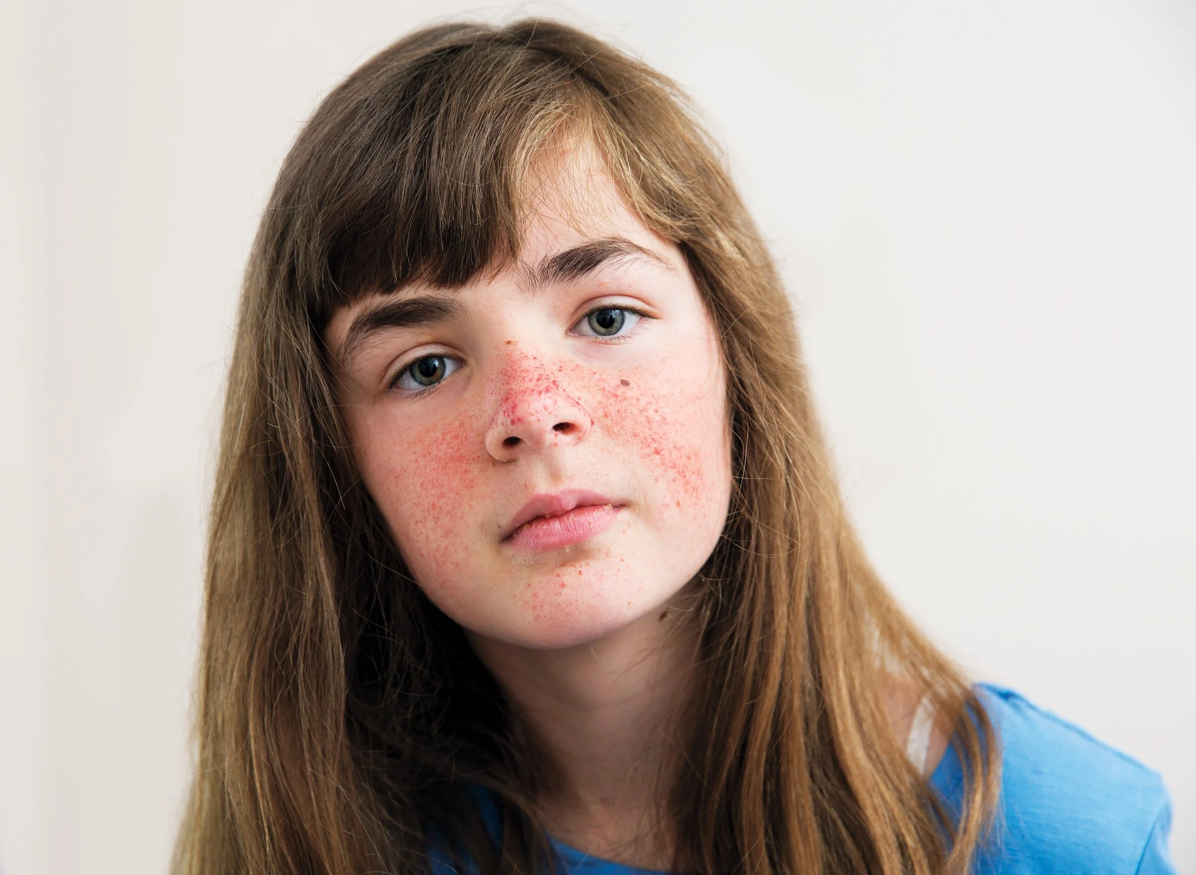 A young girl with long brown hair, light skin, blue eyes, and freckles on her face, wearing a blue shirt, looking at the camera with a neutral expression.