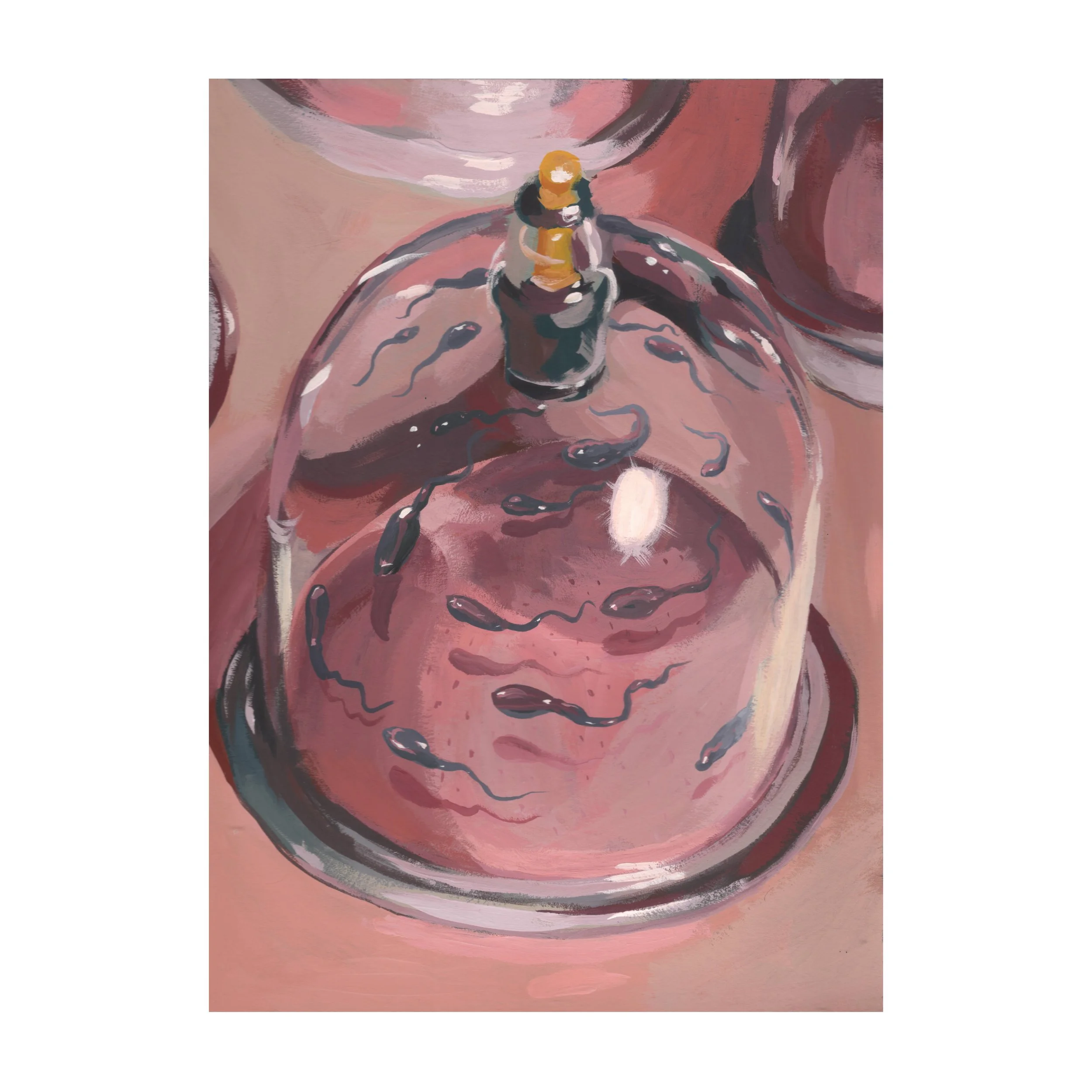 "Cupping"