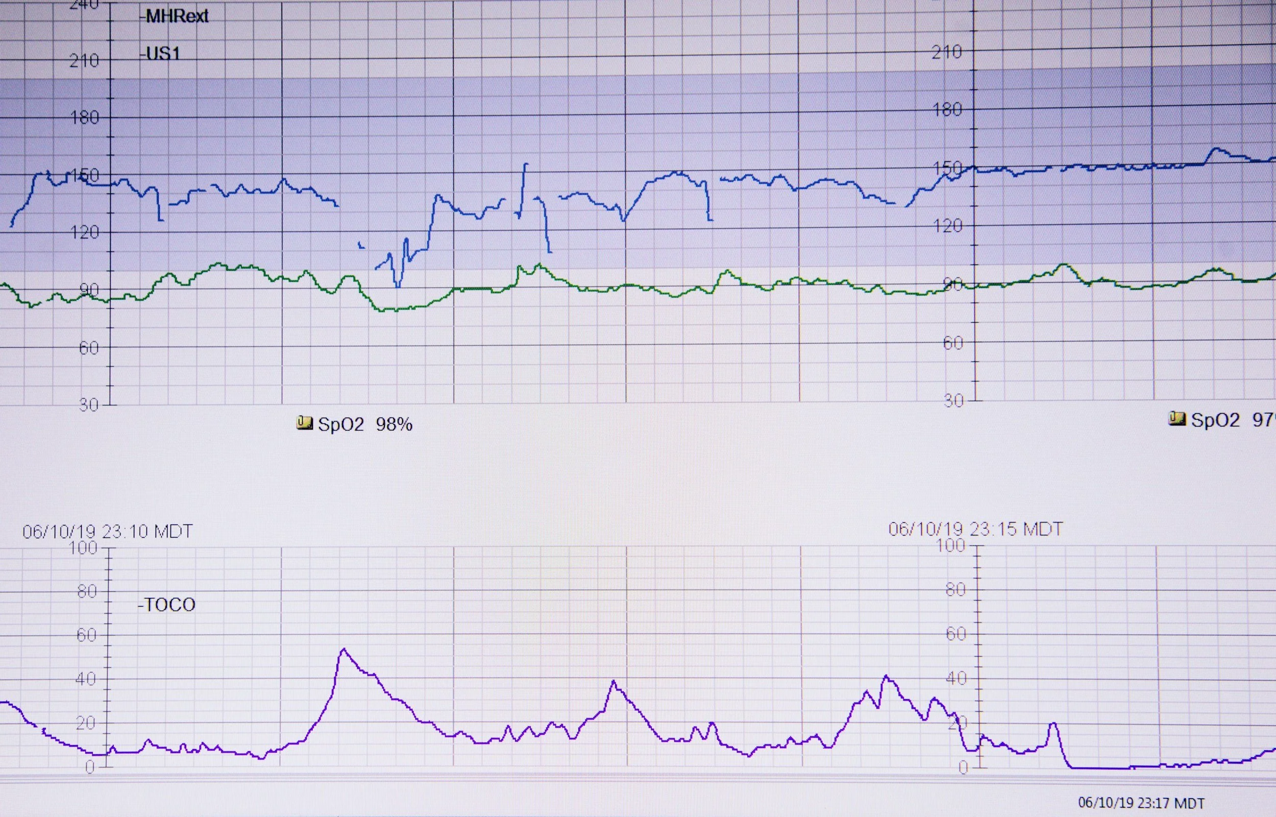Medical vital signs chart showing heart rate, oxygen saturation, and TOCO over time with intervals marked in June 2019.