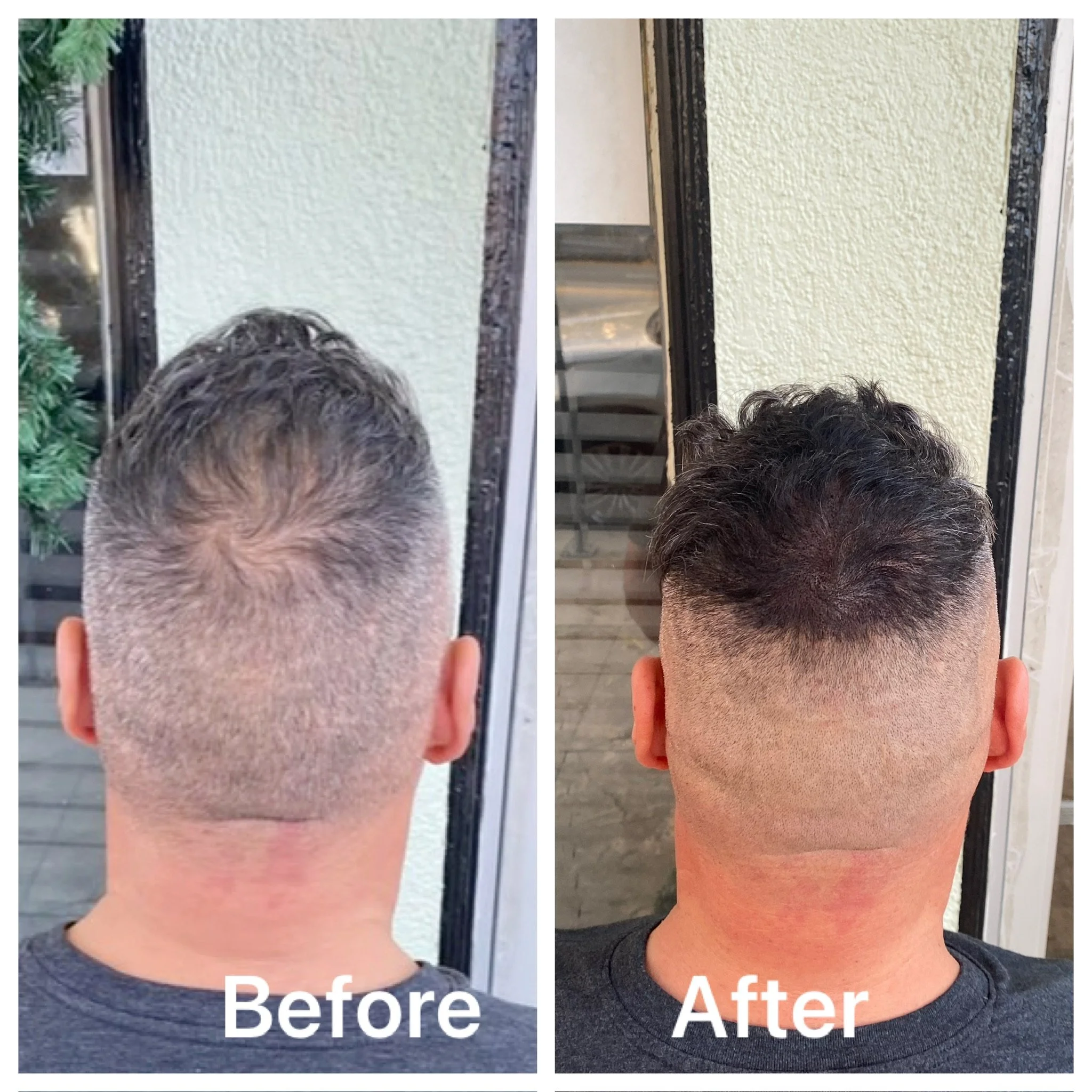 Side-by-side comparison of the back small patch fill in transformation, with 'Before' and 'After' labels.