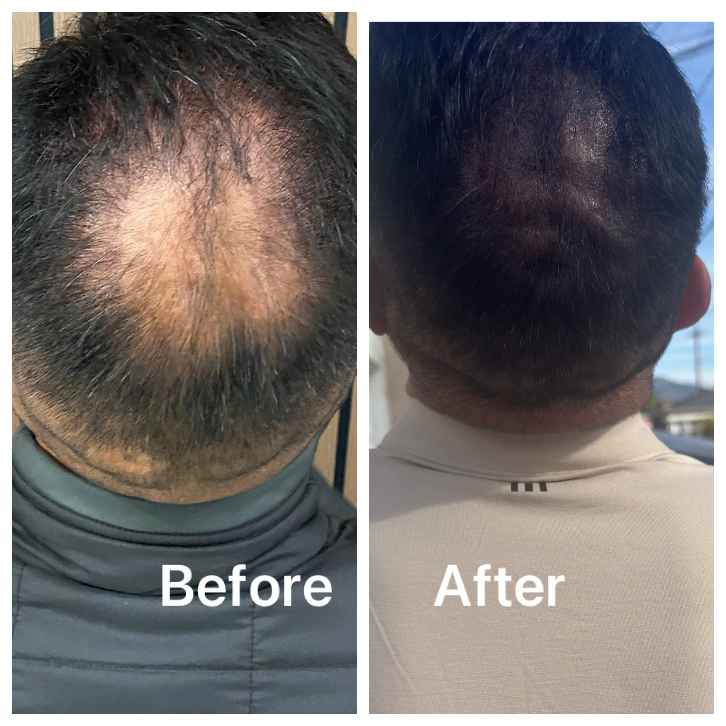 Large area fill-in/cover up.