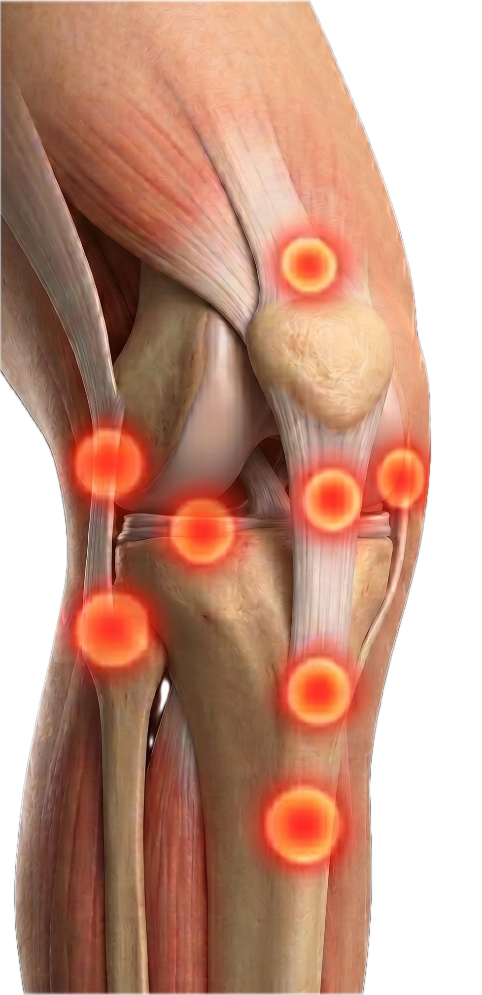 Detailed anatomical illustration of a human knee joint highlighting areas of pain or inflammation with red glowing spots.