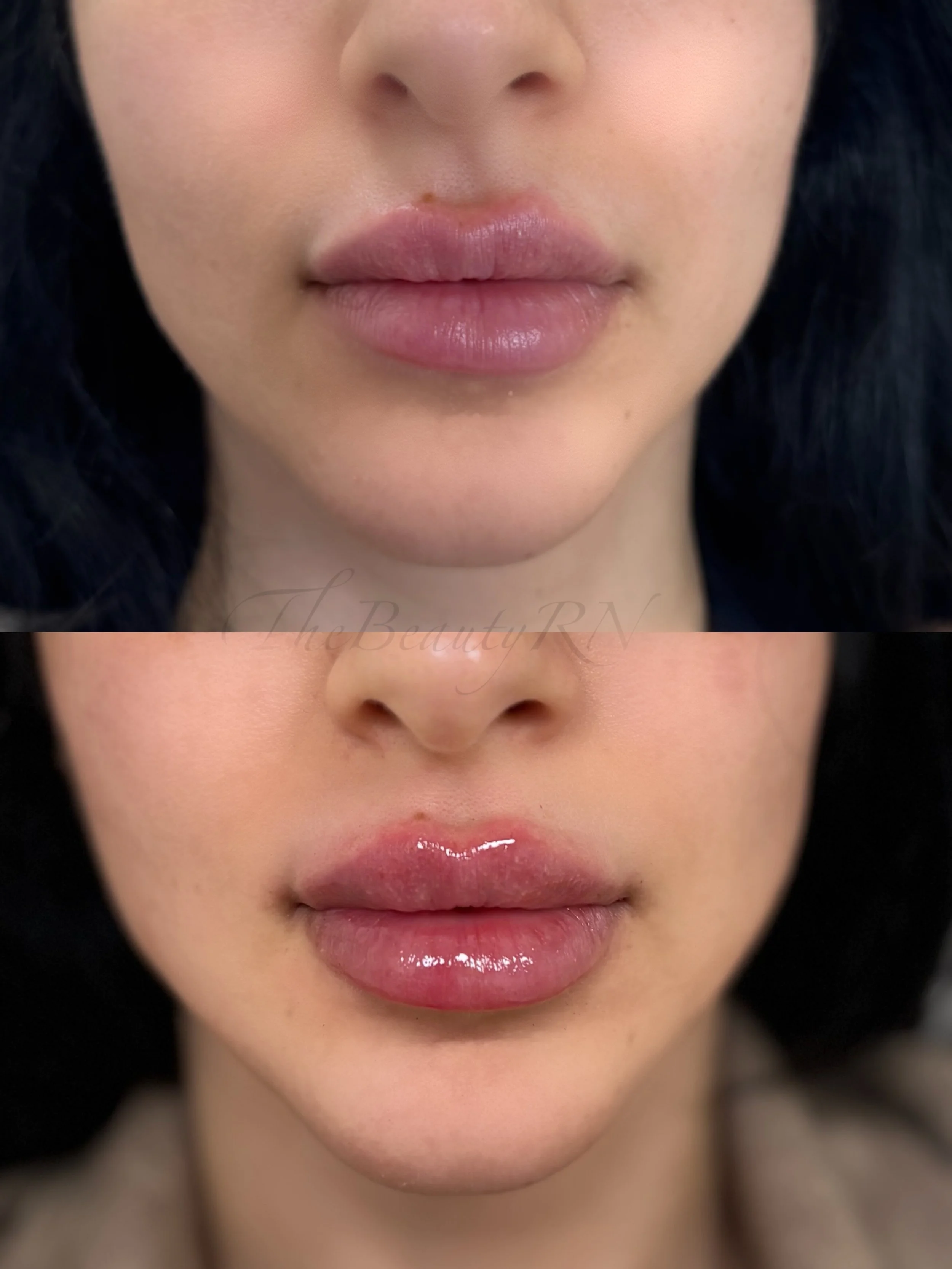 Close-up of a woman's lips before and after applying lip gloss, with natural skin tone and dark hair.