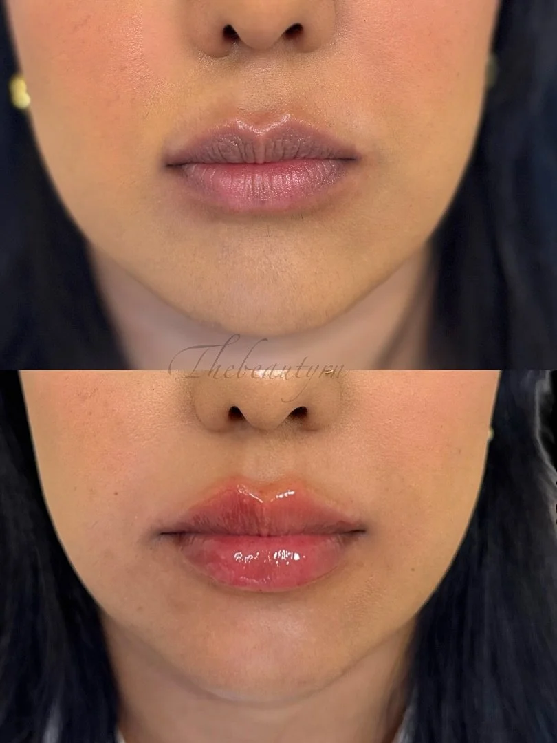Close-up of a woman's lips before and after applying glossy lip gloss or lipstick, with the second image showing shiny, well-moisturized lips.
