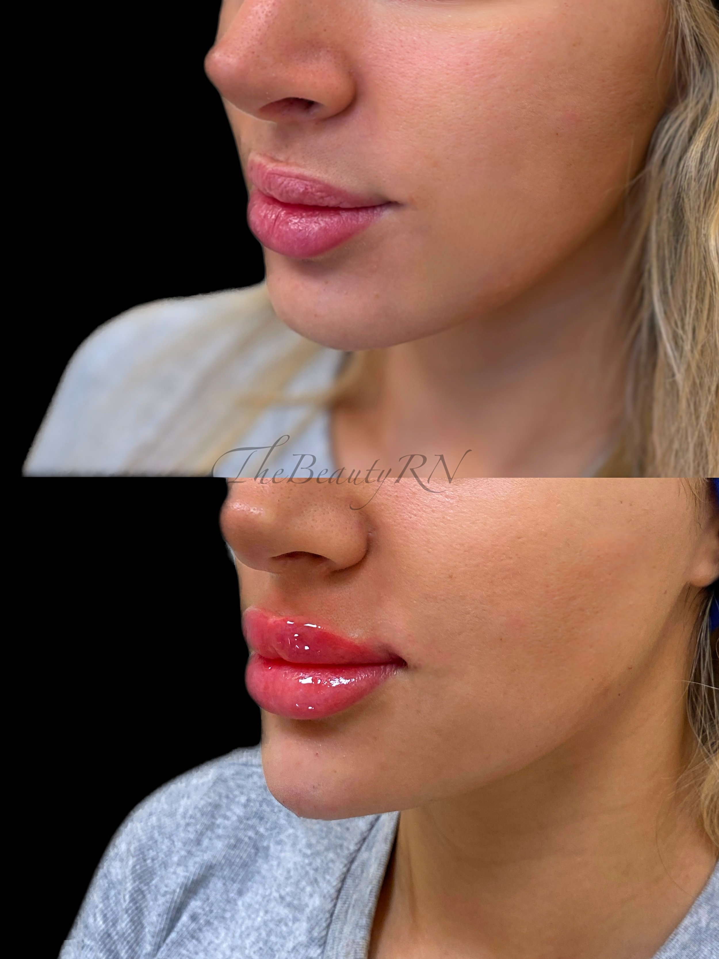 Close-up of a woman's lips before and after applying lip gloss, showing a shiny, glossy finish in the after image.