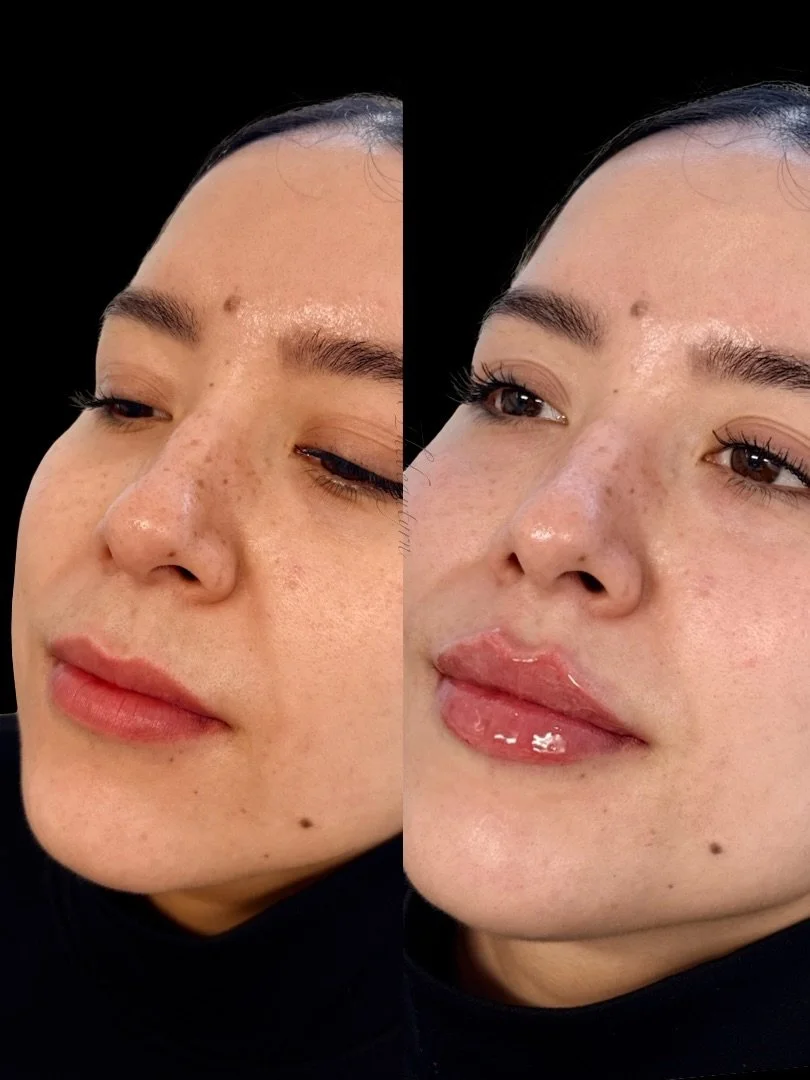 Close-up of a woman's face showing a before-and-after comparison of skincare or makeup application, with clear skin and glossy lips.