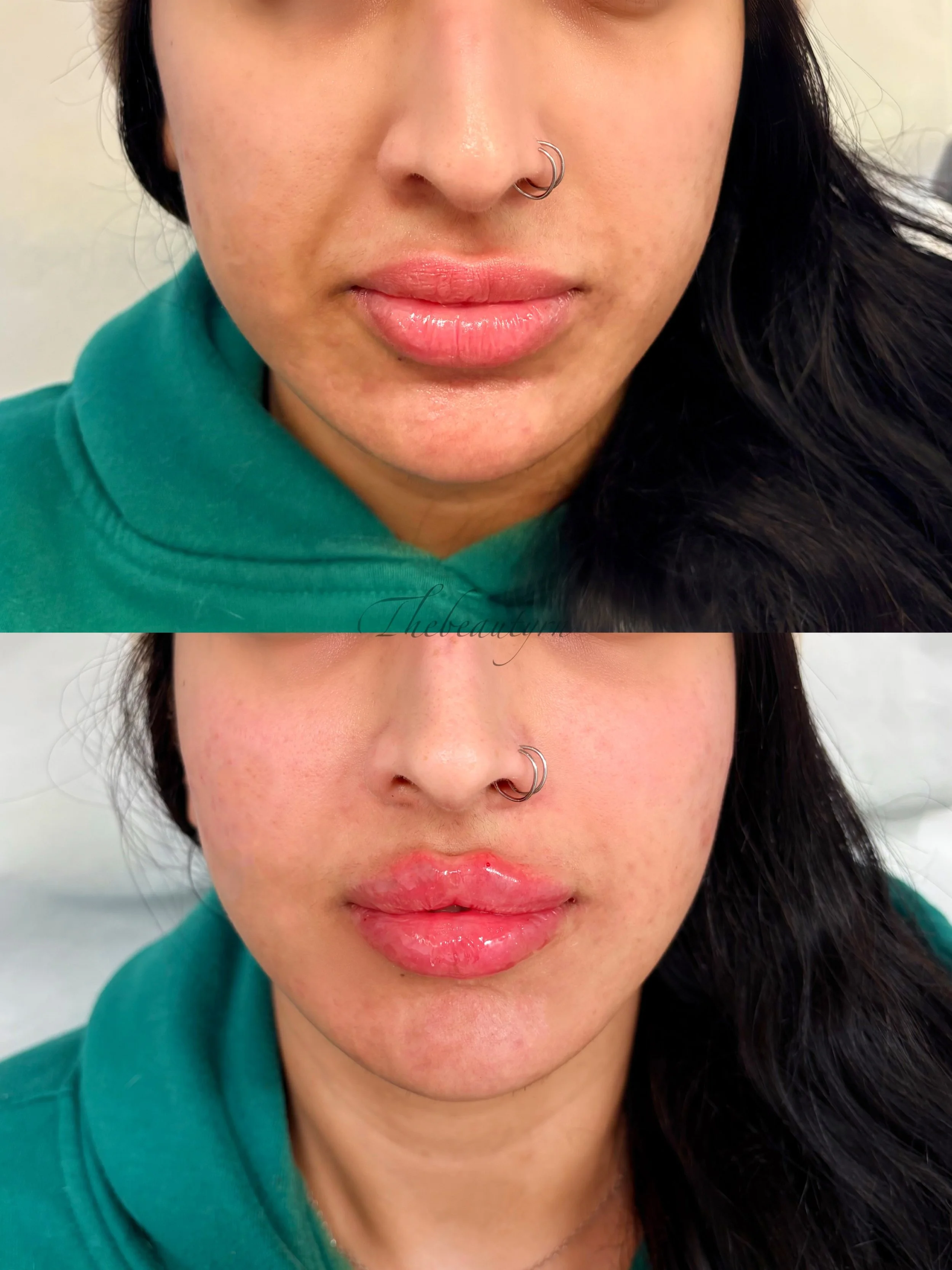 Facetune_20-12-2025-11-58-21.jpeg