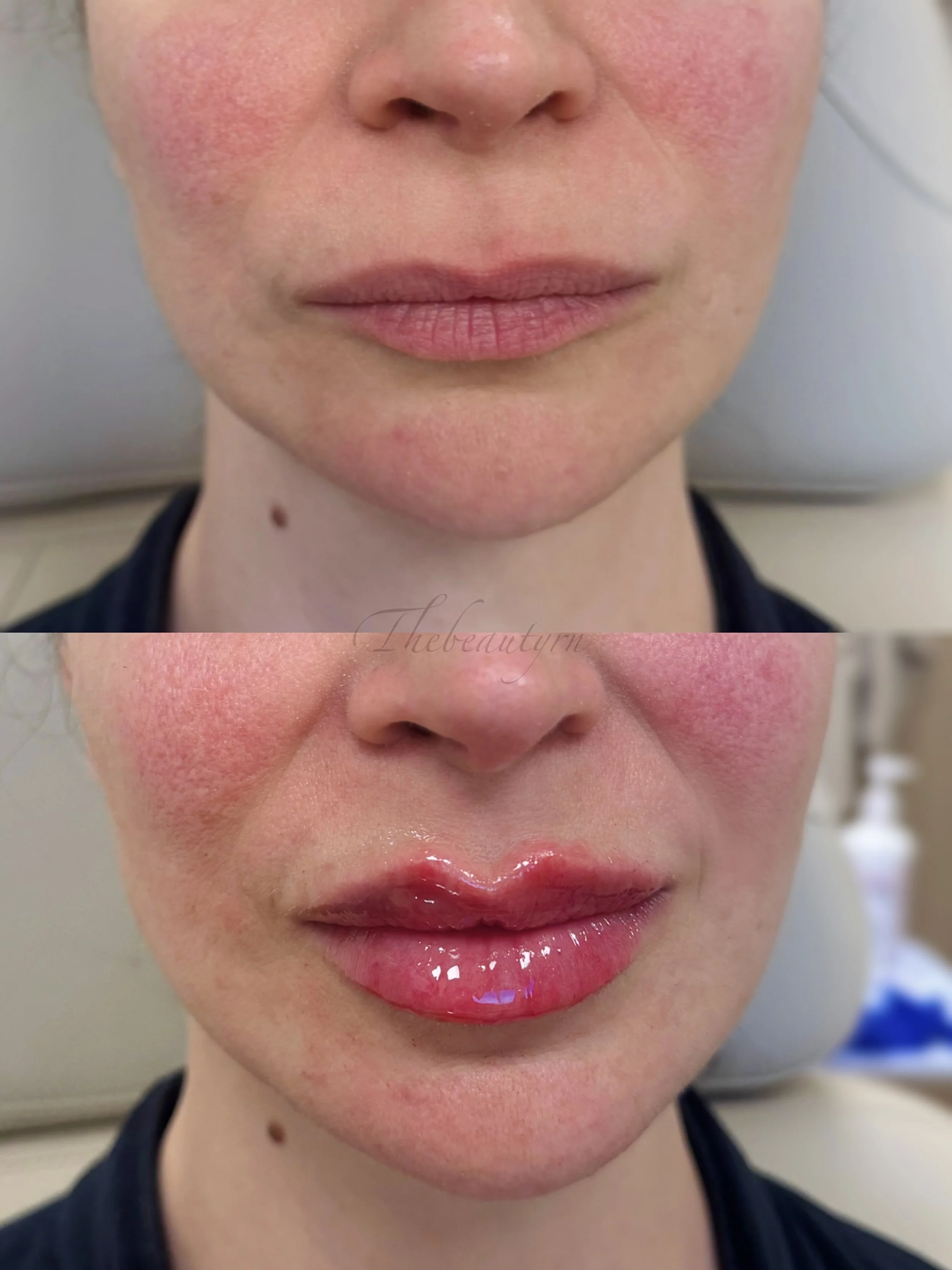 Before and after photos of a woman's lips, with the second showing her lips shiny and enhanced with gloss.
