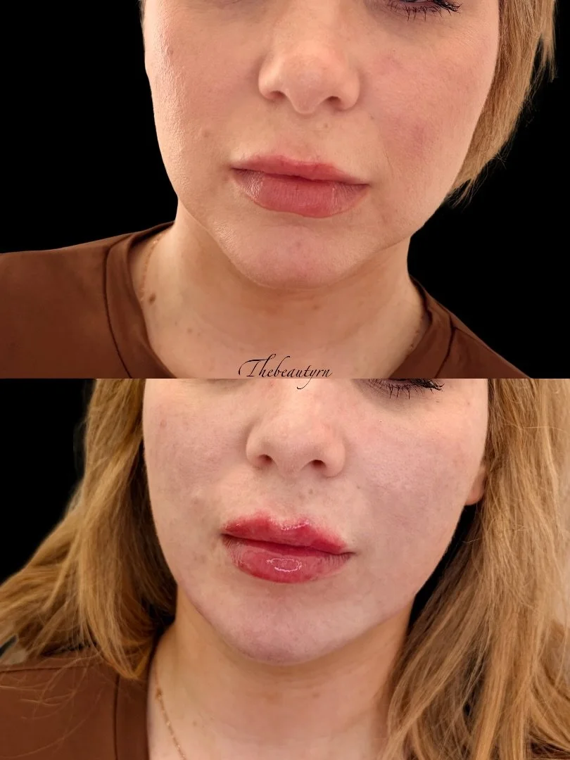 Facetune_07-04-2026-16-59-12.jpeg