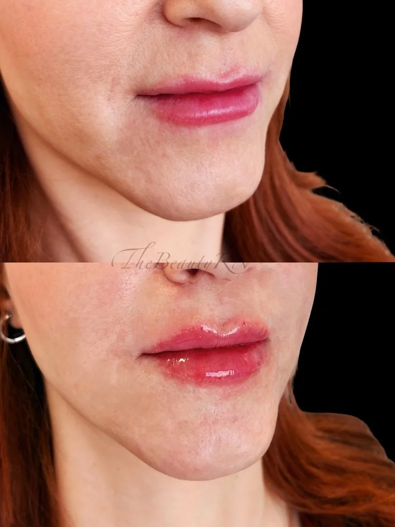 Close-up of a woman's lips before and after applying clear lip gloss, with smooth skin and red hair visible.