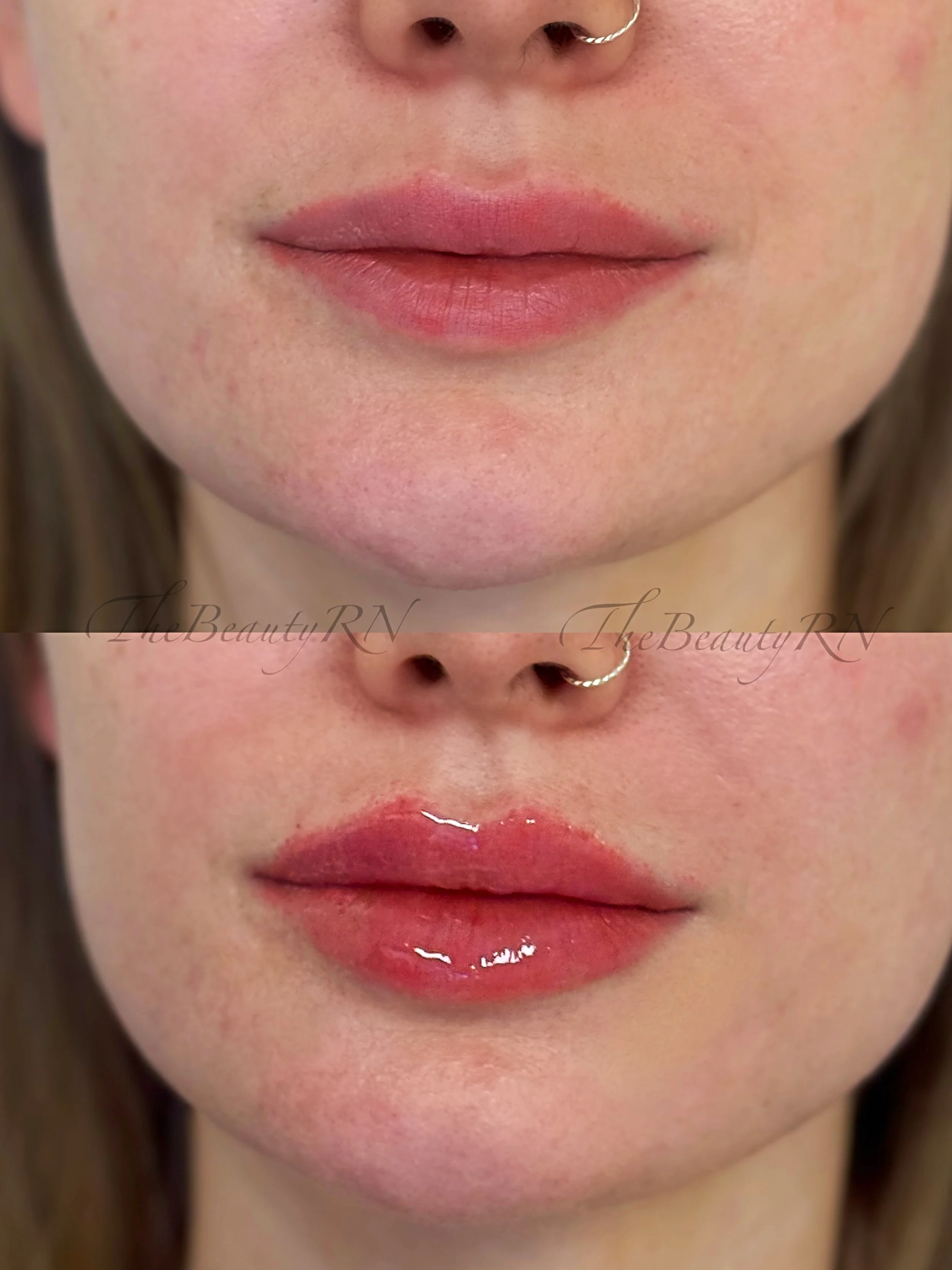 Close-up of a person's lips before and after applying lip gloss, with the top showing natural lips and the bottom showing glossy, shiny lips.