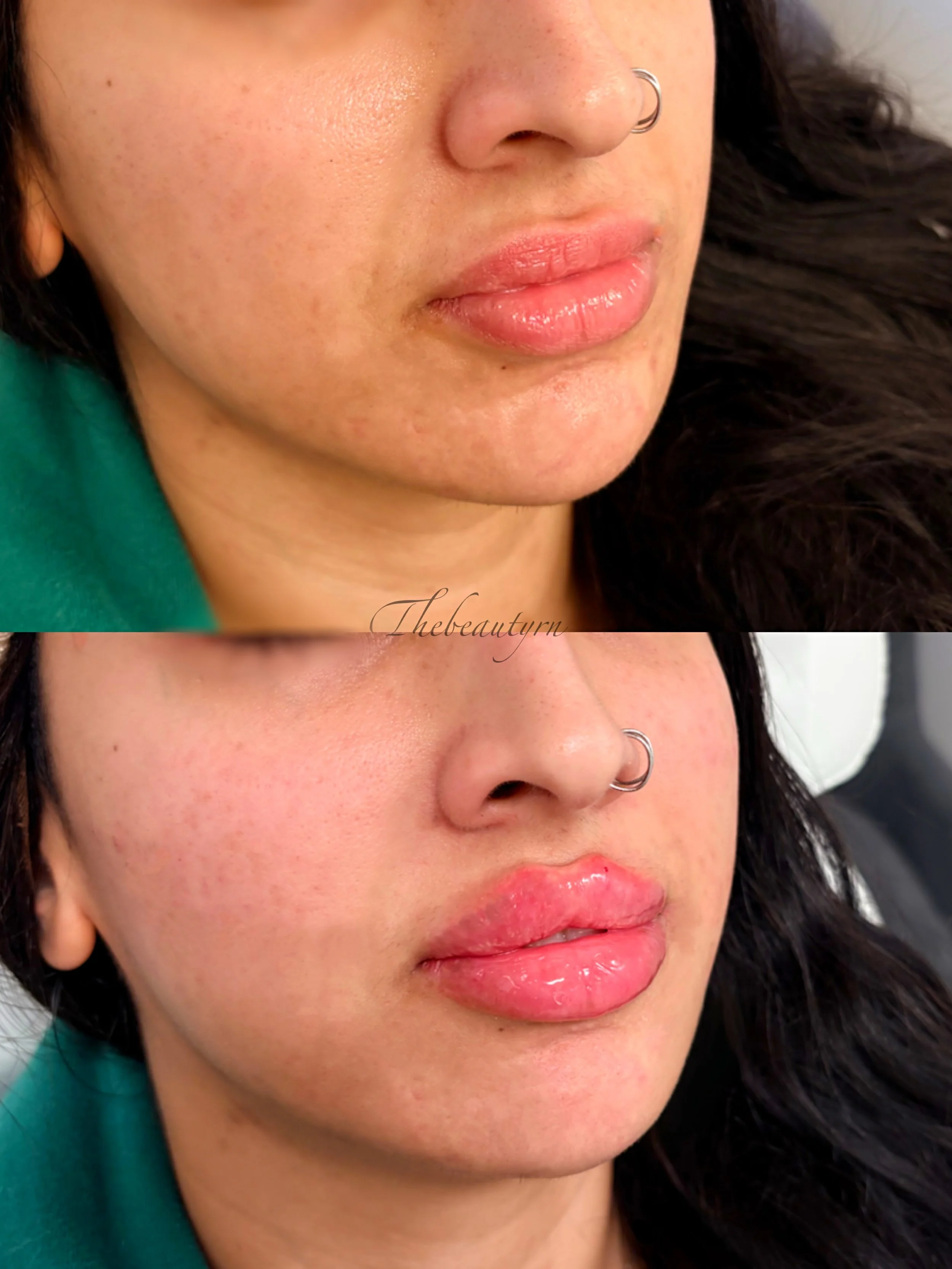 Facetune_20-12-2025-12-02-50.jpeg