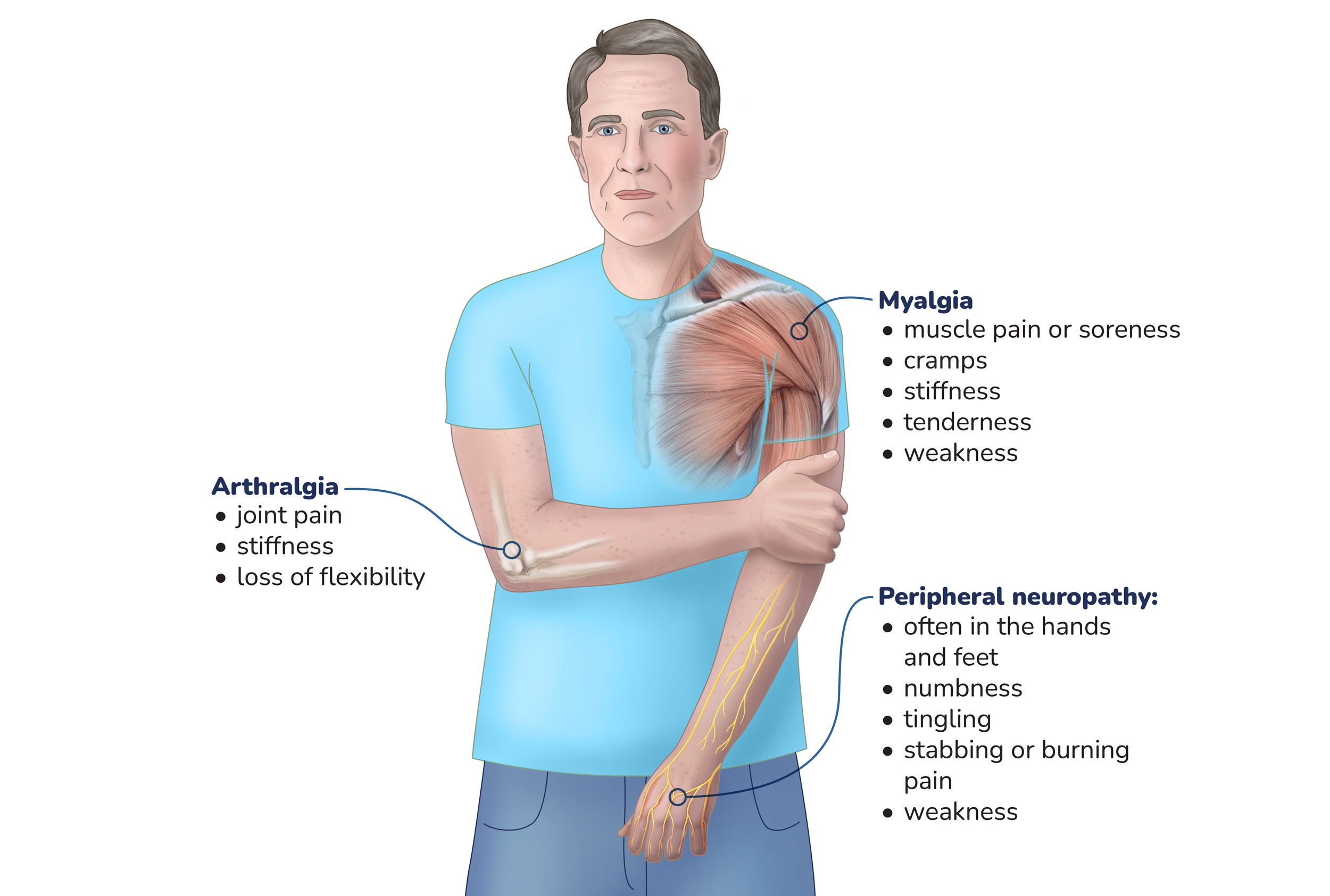 Myalgia: muscle pain or soreness, cramps, stiffness, tenderness, weakness. Arthralgia: joint pain, stiffness, loss of flexibility. Peripheral neuropathy: often in the hands and feet, numbness, tingling, stabbing or burning pain, weakness.