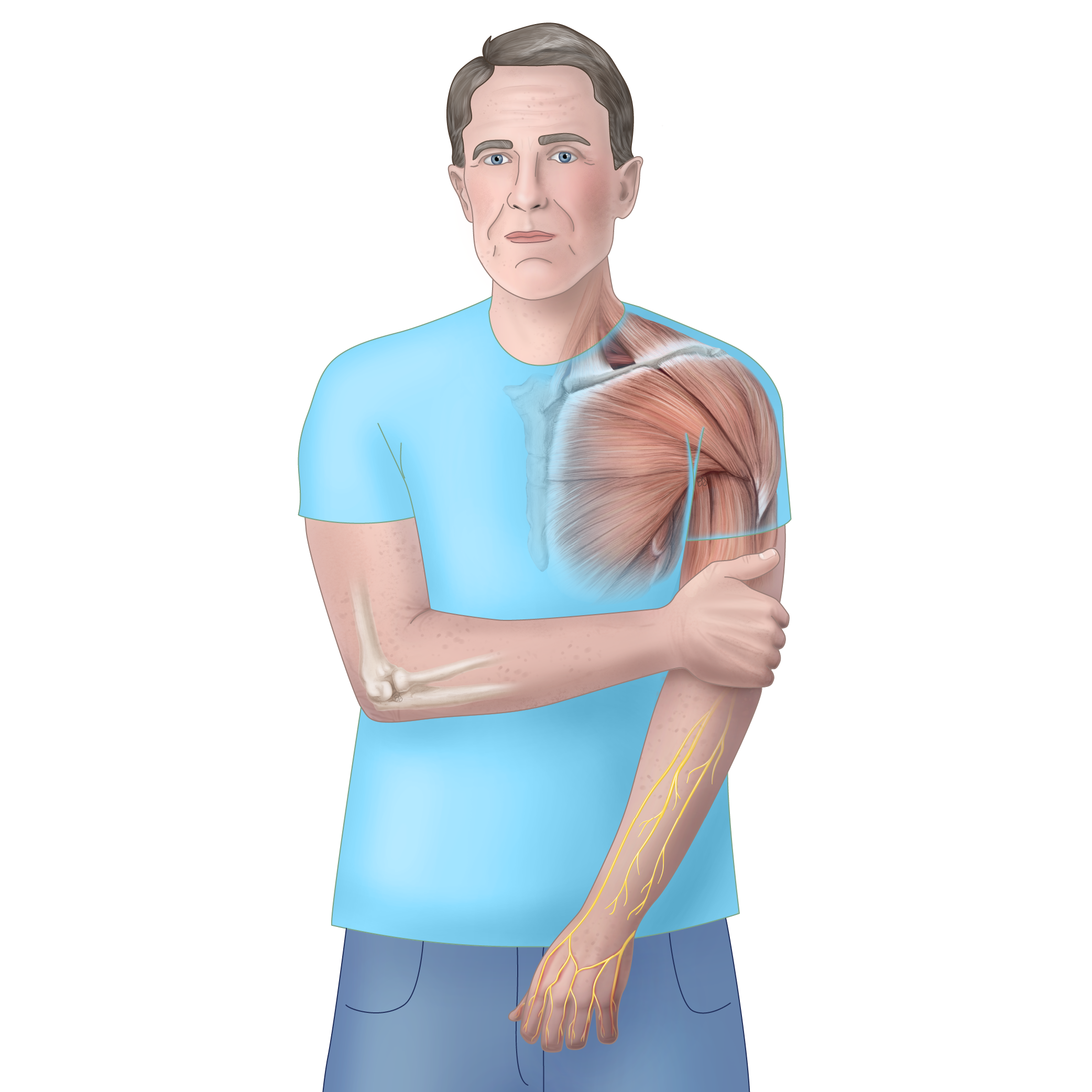 Elderly white man holding elbow. Shoulder musculature and elbow bones are shown transparently.