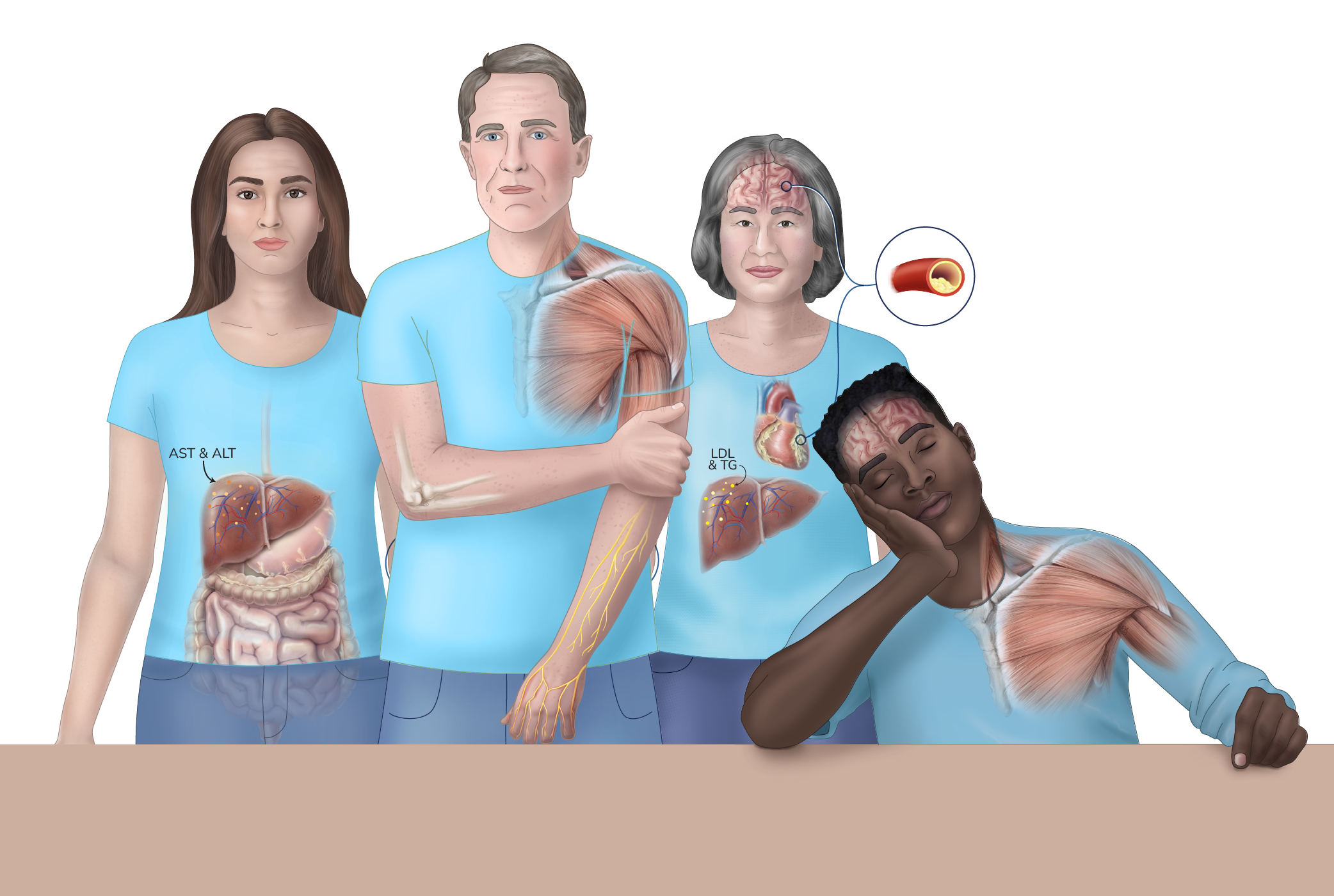 Illustration of four people with side effects caused by ALK inhibitors