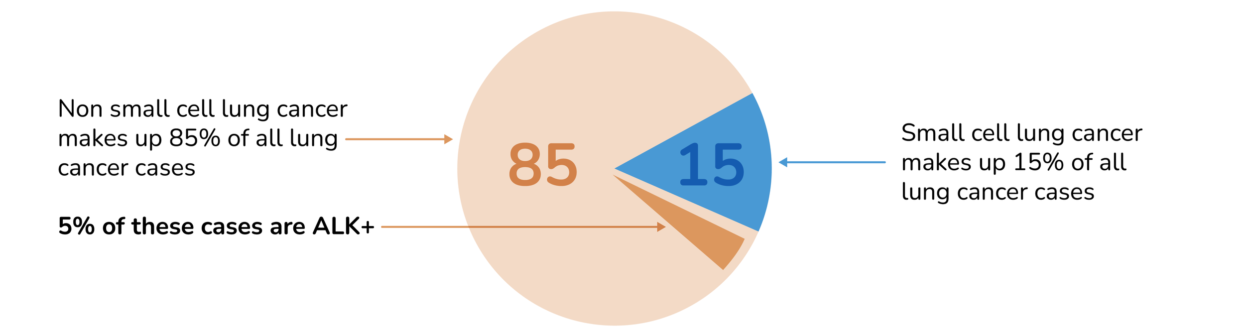 Illustration of a pie chart reading: Non small cell lung cancer makes up 85% of all lung cancer cases. 5% of these cases are ALK+. Small cell lung cancer makes up 15% of all lung cancer cases.