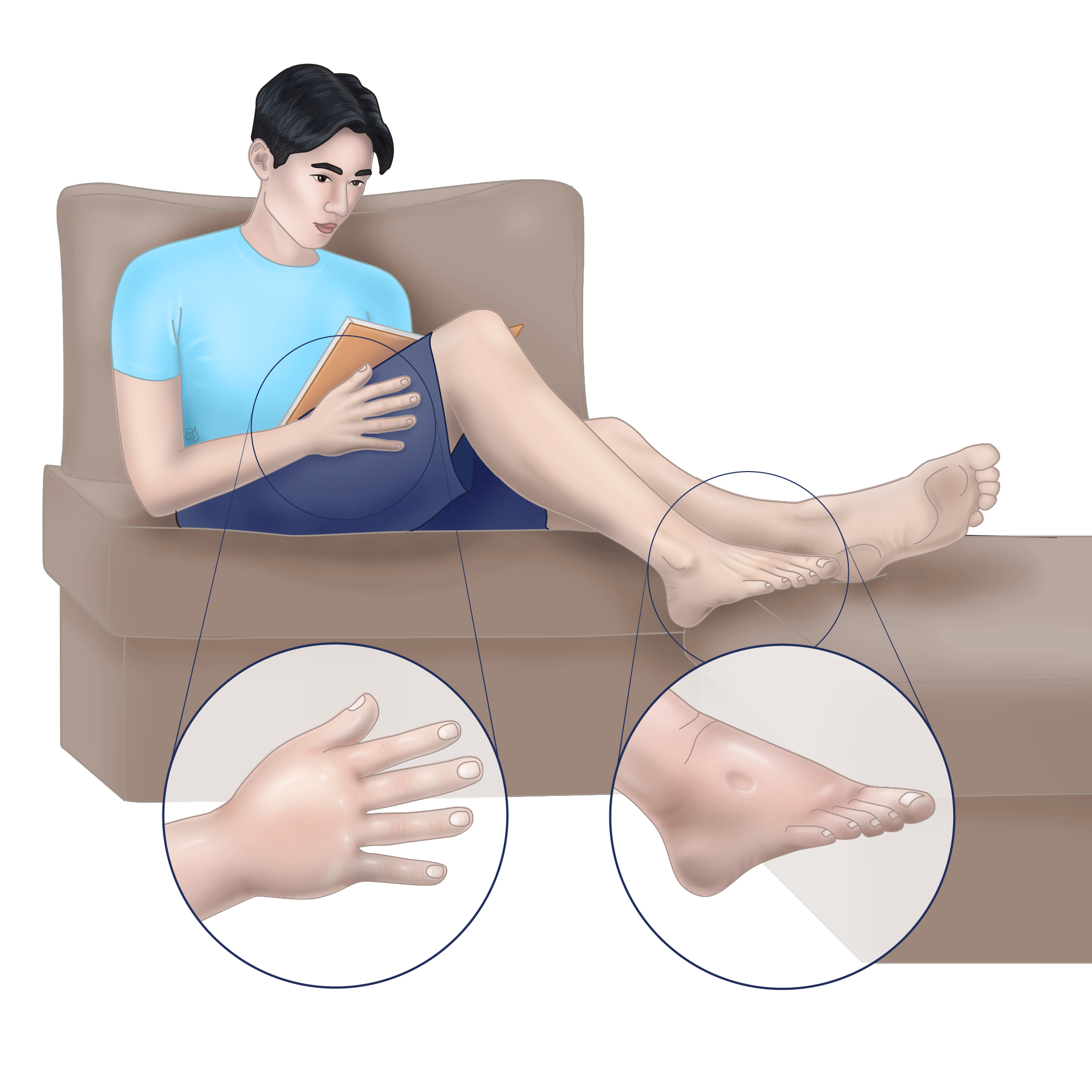 Asian man reading book on couch. hand and feet are shown to be swollen.