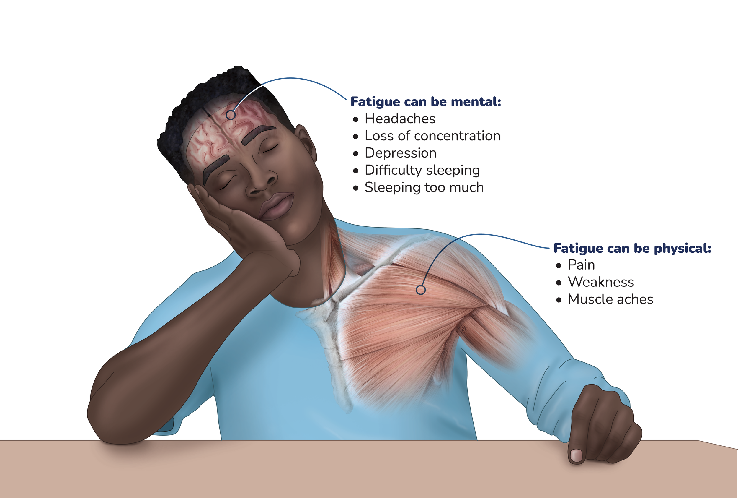 Fatigue can be mental: headaches, loss of concentration, depression, difficulty sleeping or sleeping too much. fatigue can be physical: pain, weakness, muscle aches