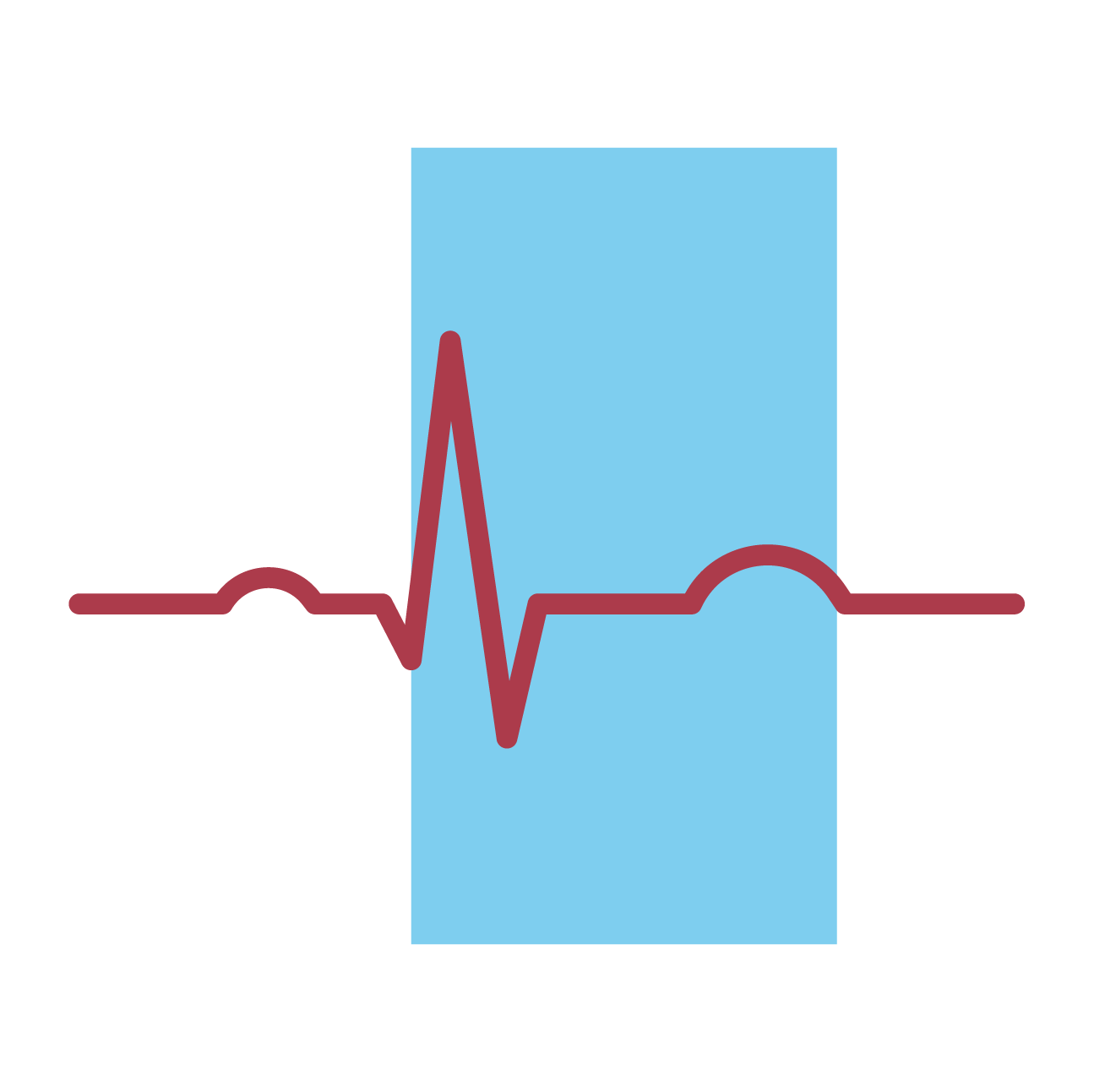 Illustration of an electrocardiogram (ECG) waveform with a blue highlighted area behind it indicating the QT interval.