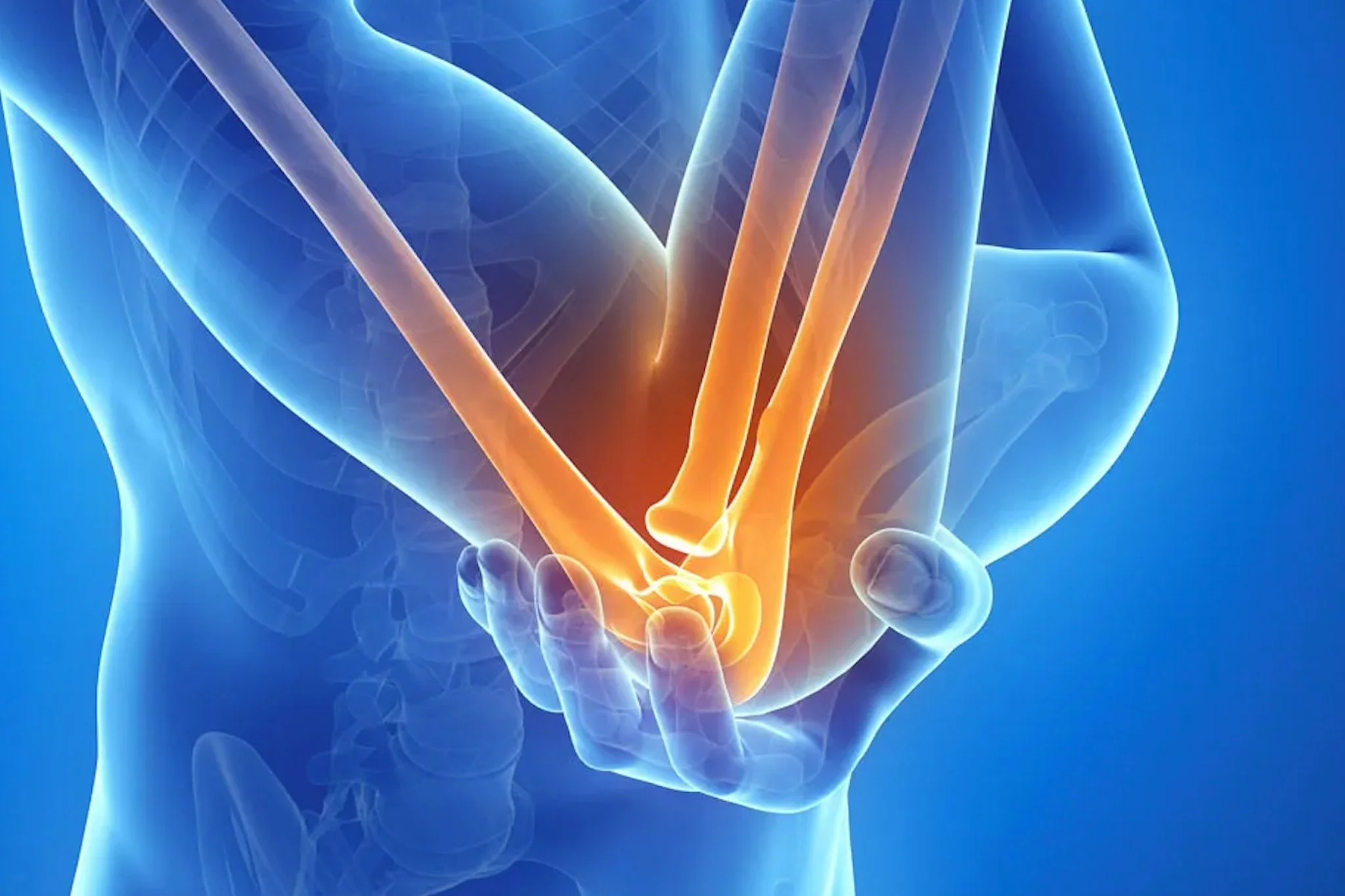 Tennis Elbow: Why Rest Isn't Enough