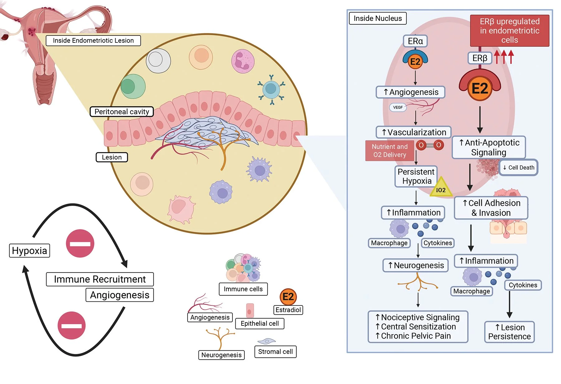 Diagram illustrating the mechanisms involved in endometriosis, including lesion formation, immune response, hypoxia, angiogenesis, and cellular signaling pathways, featuring various cells, molecules, and processes related to endometrial tissue outsid