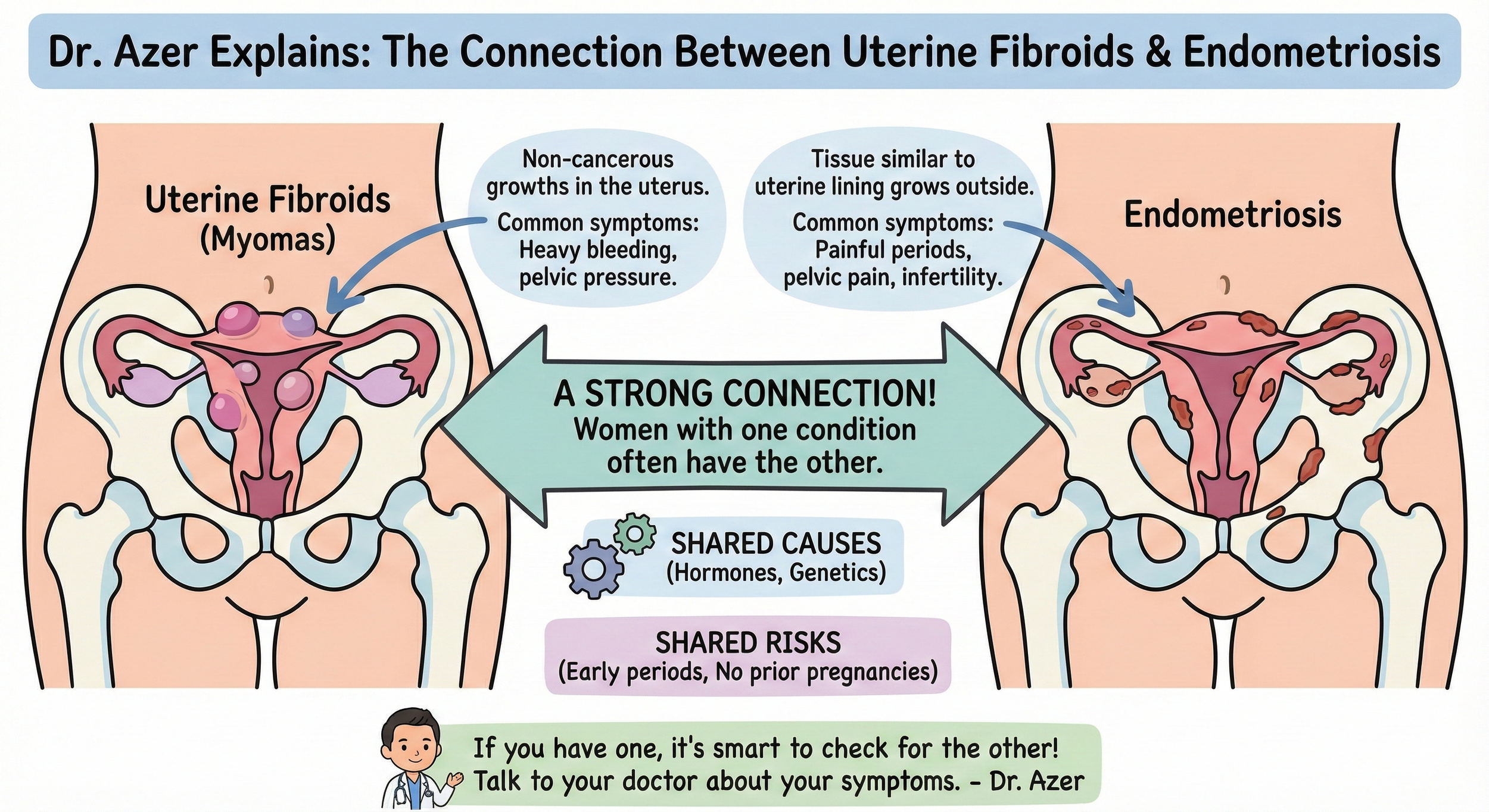 Diagram showing the connection between uterine fibroids and endometriosis, with illustrations of the uterus highlighting each condition. Text explains common symptoms, shared causes like hormones and genetics, shared risks during early periods, and a