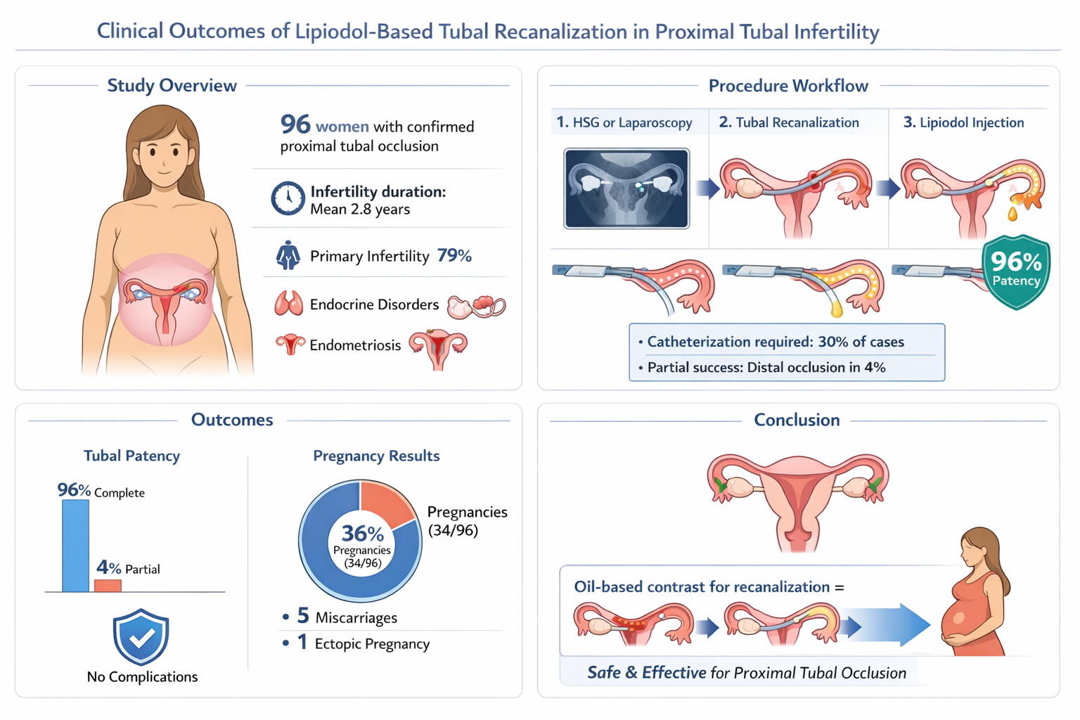 Infographic titled 'Clinical Outcomes of Lipidol-Based Tubal Recanalization in Proximal Tubal Infertility,' showing study overview, procedure workflow, outcomes, and conclusion related to tubal recanalization for infertility. Contains illustrations of female reproductive system, diagnostic imaging, procedural steps, and outcomes like patency and pregnancy rates.