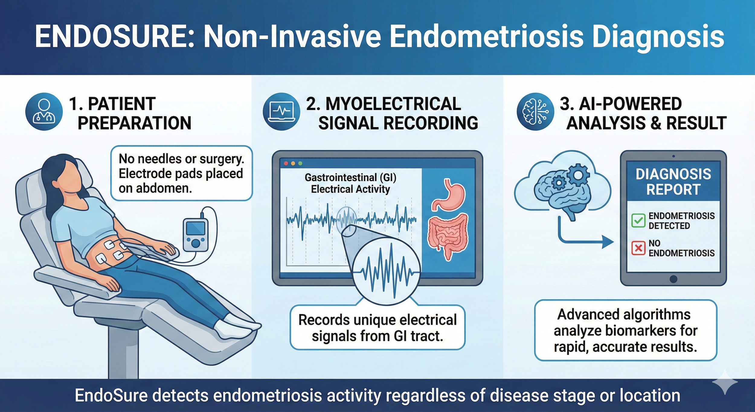 Infographic explaining the non-invasive endometriosis diagnosis process called EndoSure, including patient preparation with electrode pads on the abdomen, myoelectrical signal recording of gastrointestinal activity, and AI-powered analysis resulting in a diagnosis report confirming endometriosis detection.