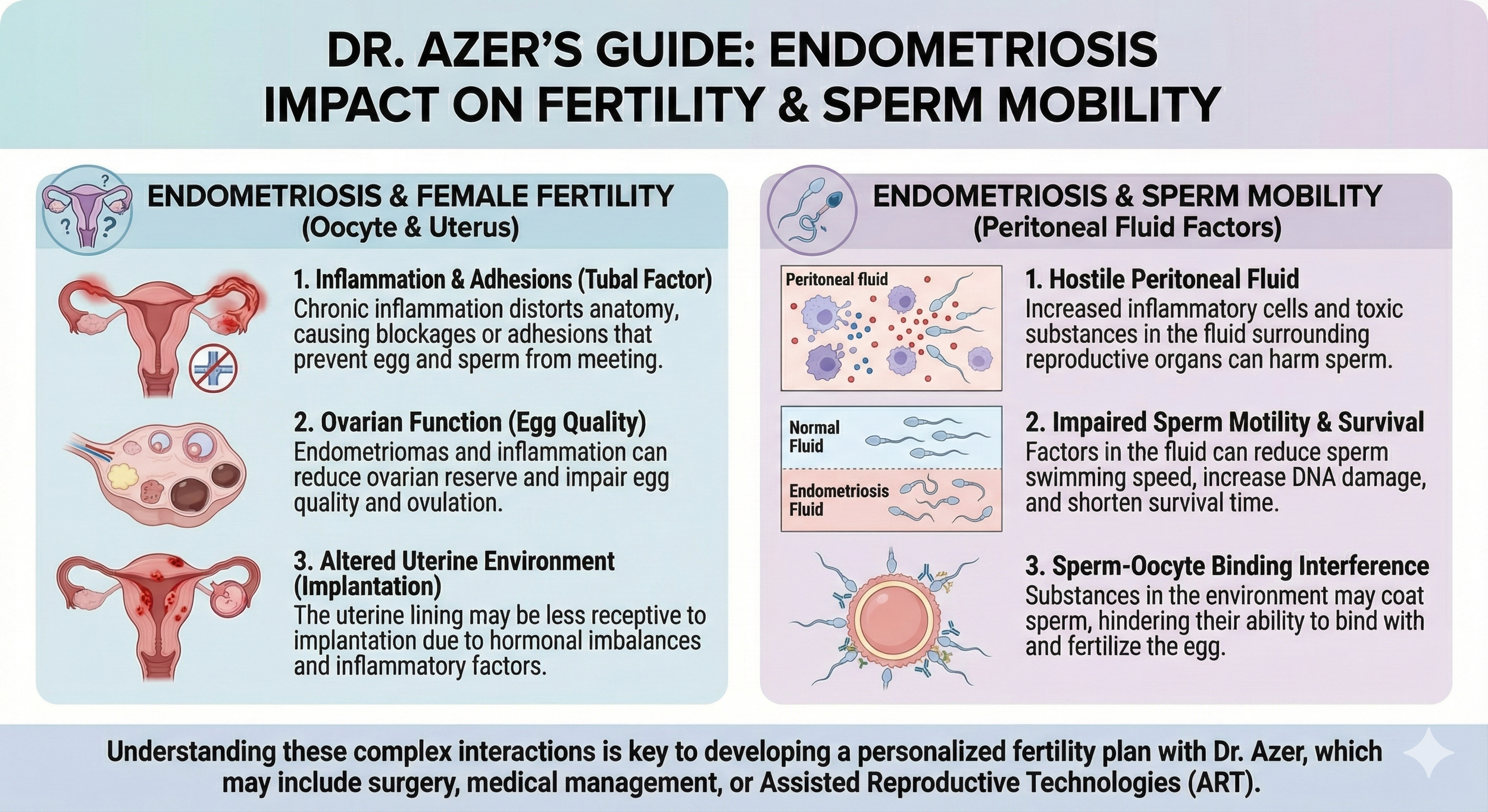 An infographic titled "Dr. Azer's Guide: Endometriosis Impact on Fertility & Sperm Mobility" outlining factors affecting endometriosis, female fertility, and sperm mobility. It includes sections on endometriosis and female fertility with illustrations of reproductive organs, and endometriosis and sperm mobility with diagrams of peritoneal fluid, normal fluid, and endometriosis fluid, as well as sperm and egg interaction.