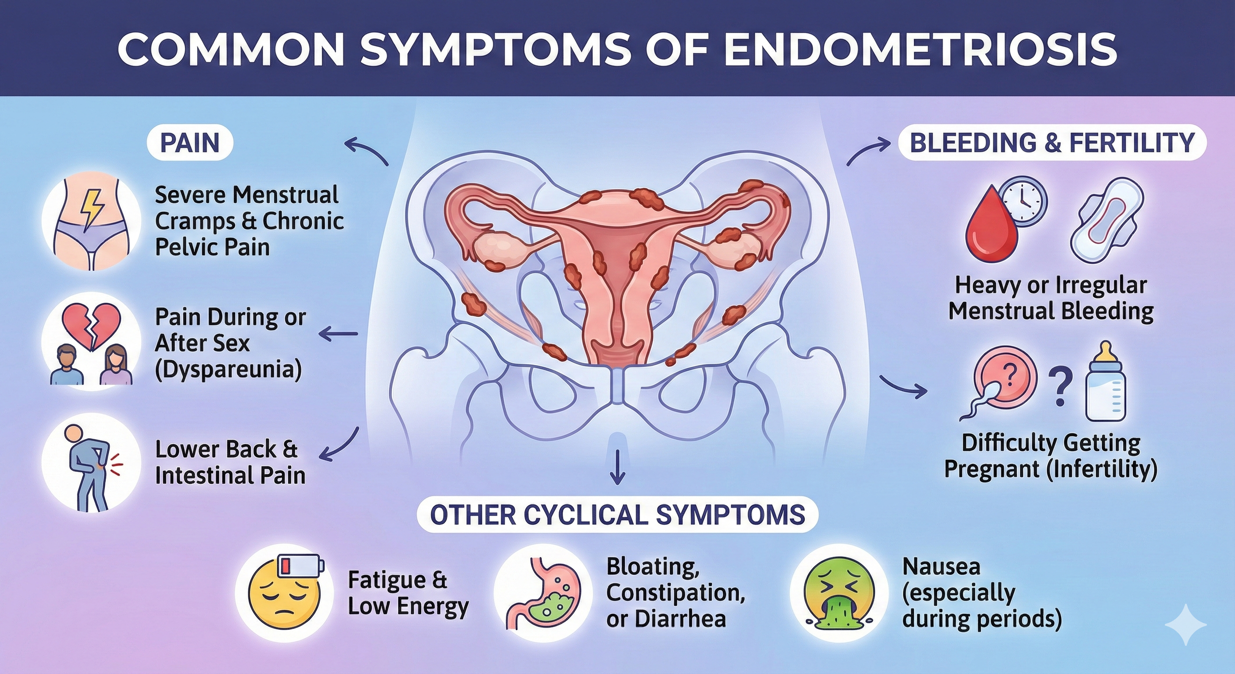Infographic of common symptoms of endometriosis, including severe menstrual cramps, pelvic pain, pain during or after sex, lower back and intestinal pain, fatigue, bloating, constipation, nausea, heavy menstrual bleeding, difficulty getting pregnant,