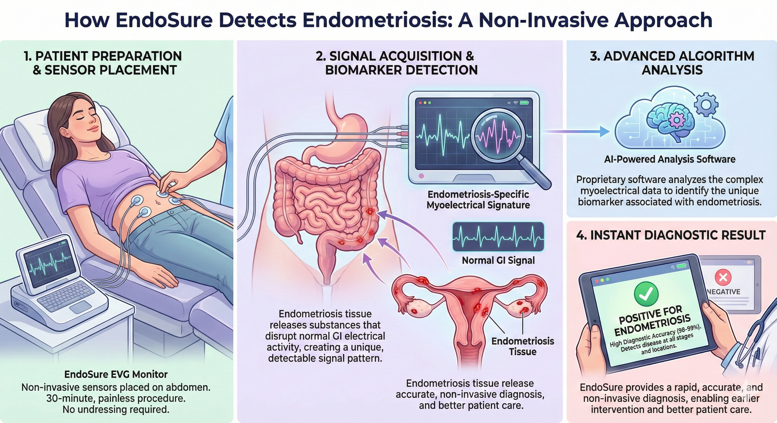 An infographic illustrating how EndoSure detects endometriosis using a non-invasive approach. It includes four steps: patient preparation with sensors on abdomen, signal acquisition from the gastrointestinal tract showing the endometriosis-specific m