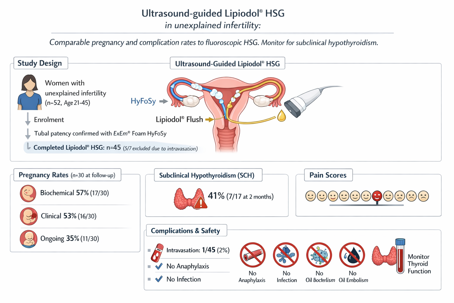 Infographic about ultrasound-guided Lipiodol HSG for unexplained infertility, showing study design, pregnancy rates, subclinical hypothyroidism, pain scores, and safety outcomes.