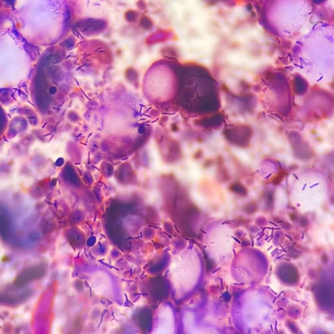 Meet The Yeast: The Sprinter vs. The Marathon Runner