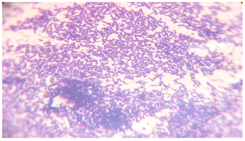 The Survivor: Lactobacillus plantarum