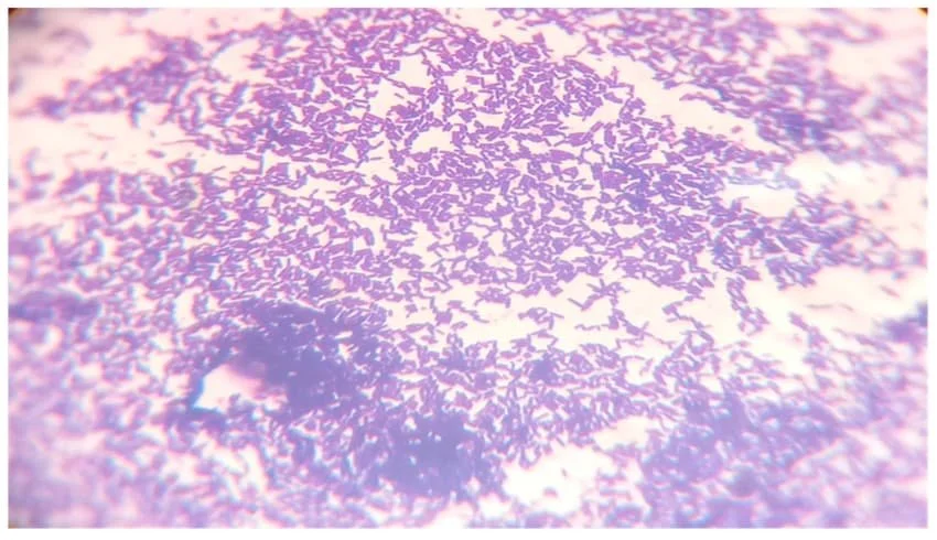 The Survivor: Lactobacillus plantarum