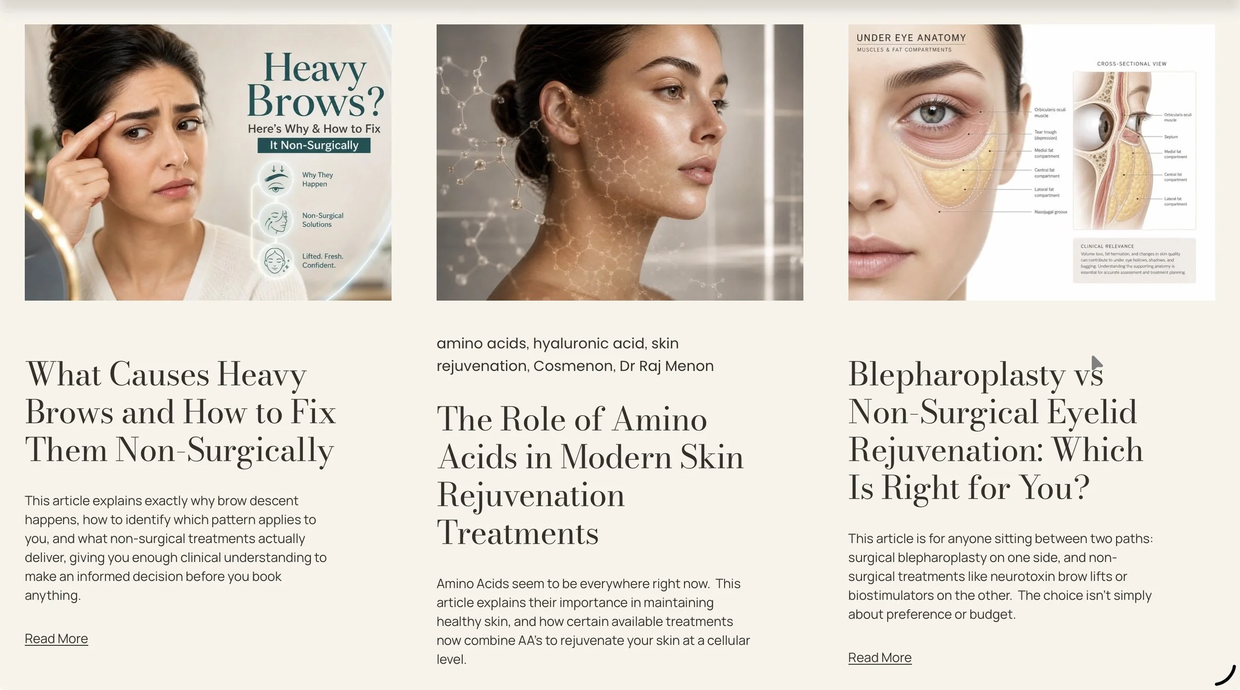 A collage of three images related to skincare and aesthetics. The first image shows a woman touching her temple with a thoughtful expression, with a title discussing heavy eyebrows and non-surgical fixes. The second image is a close-up profile of a woman with clear skin and molecular graphics around her head, representing skin rejuvenation. The third image is a medical diagram illustrating the anatomy under the eye, showing muscles and fat compartments, with a focus on non-surgical eyelid rejuvenation, accompanied by text explaining the options and considerations.